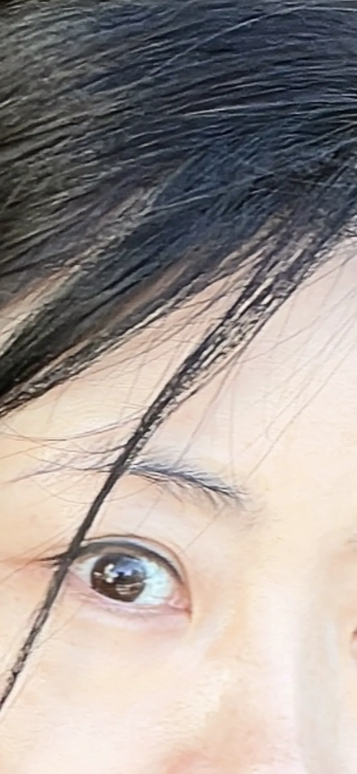시술 전 사진