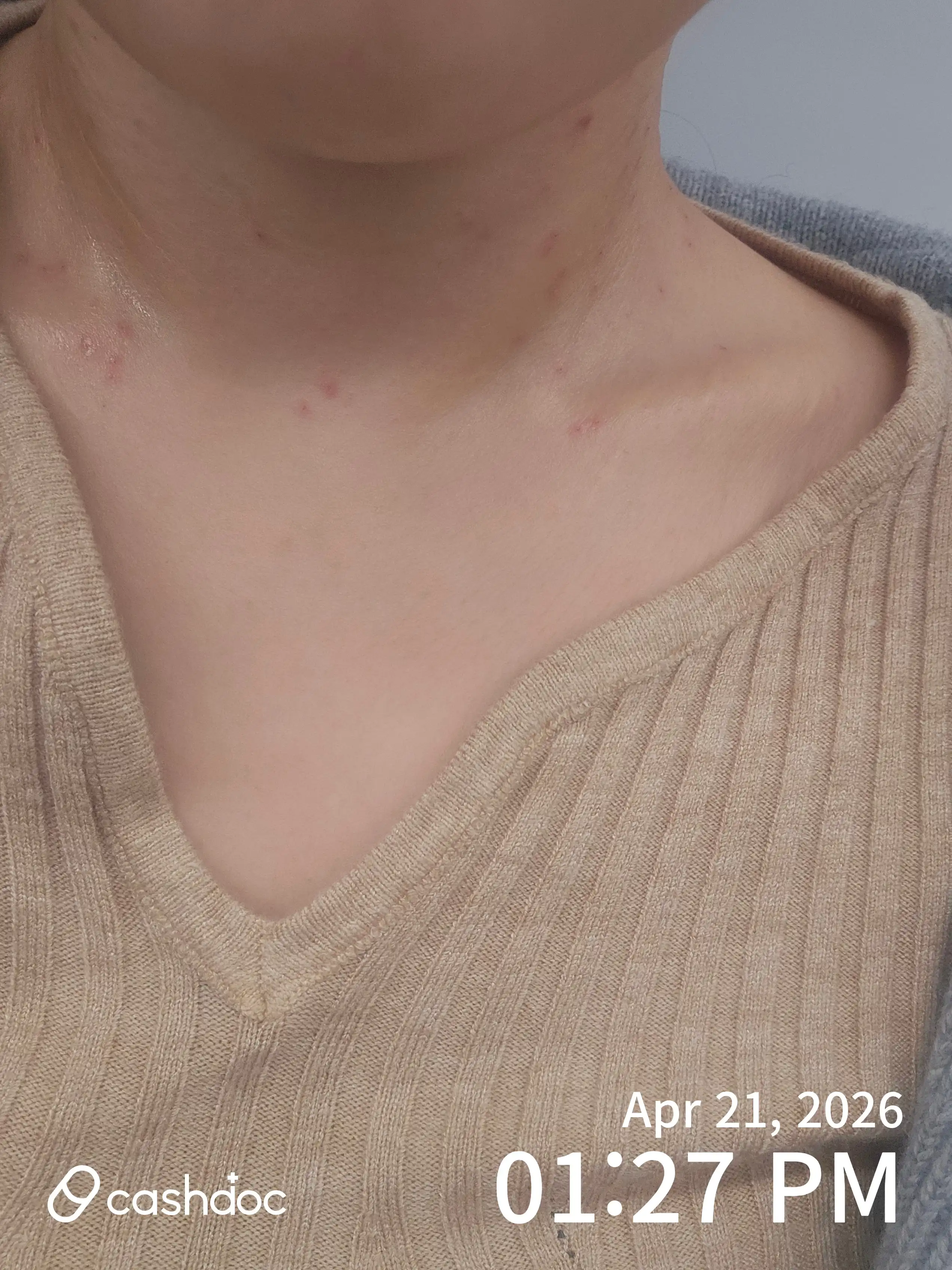 Review photo
