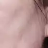 前