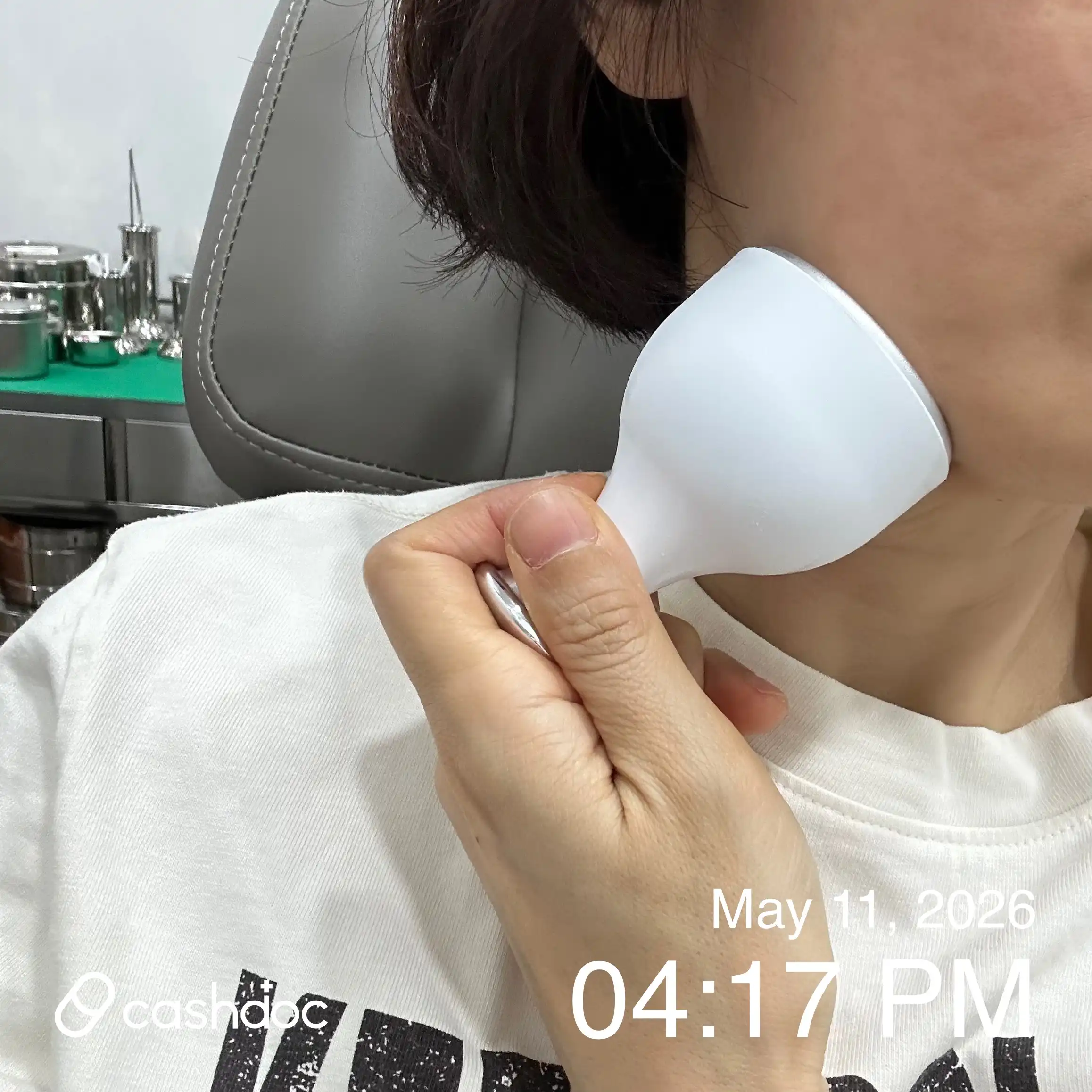 レビュー写真