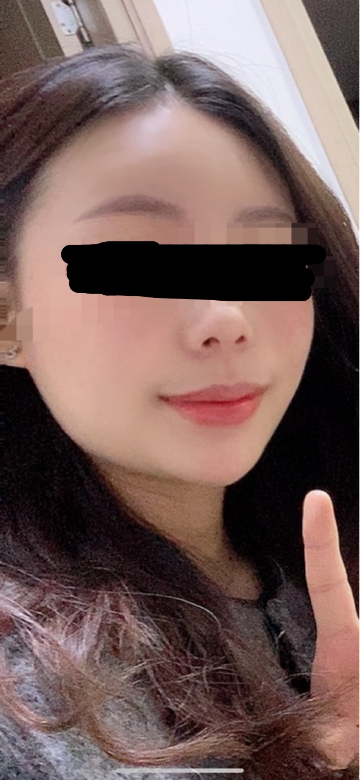 後