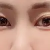 後