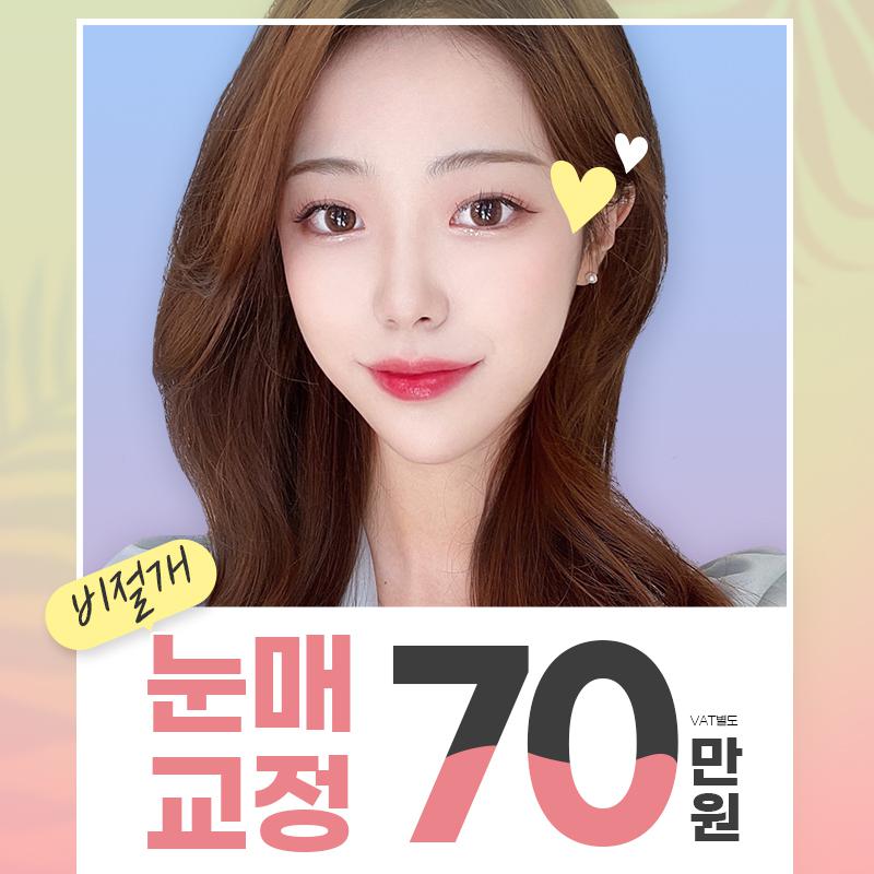 루아크 비절개눈매교정 이벤트 썸네일 이미지