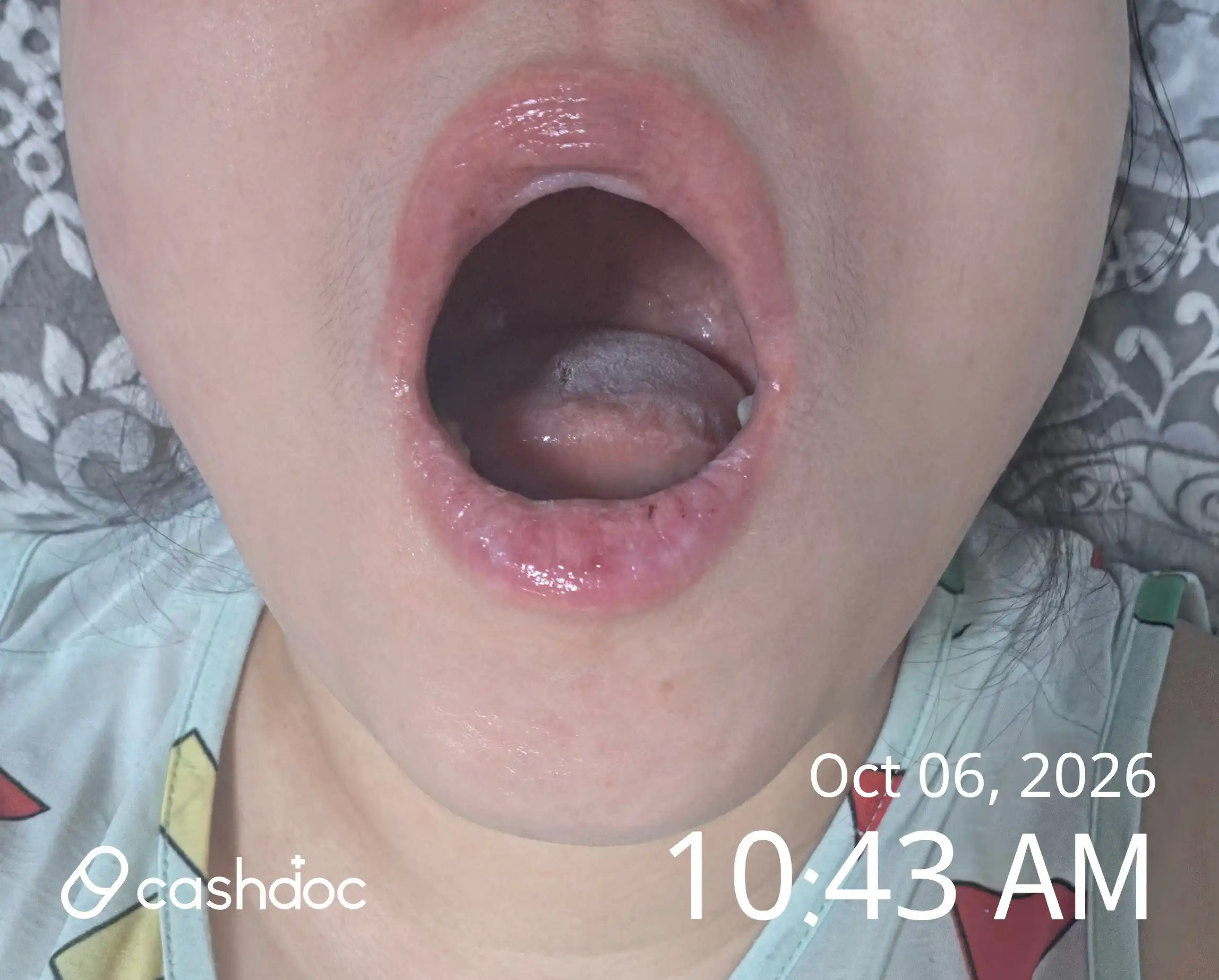 Review photo