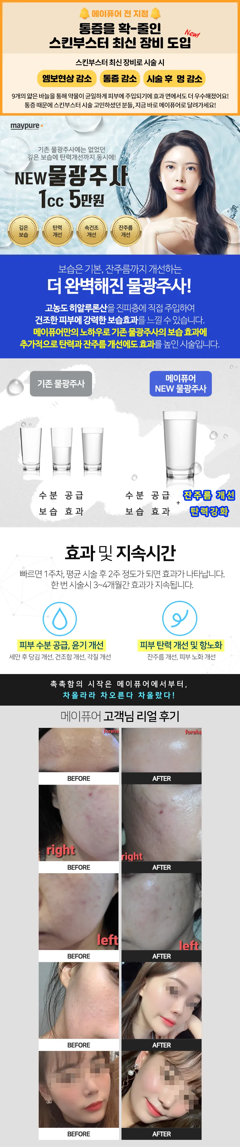 메이퓨어의원 성남태평점 당김없는 촉촉함 #물광주사 특가 이벤트, 시술 상세 이미지