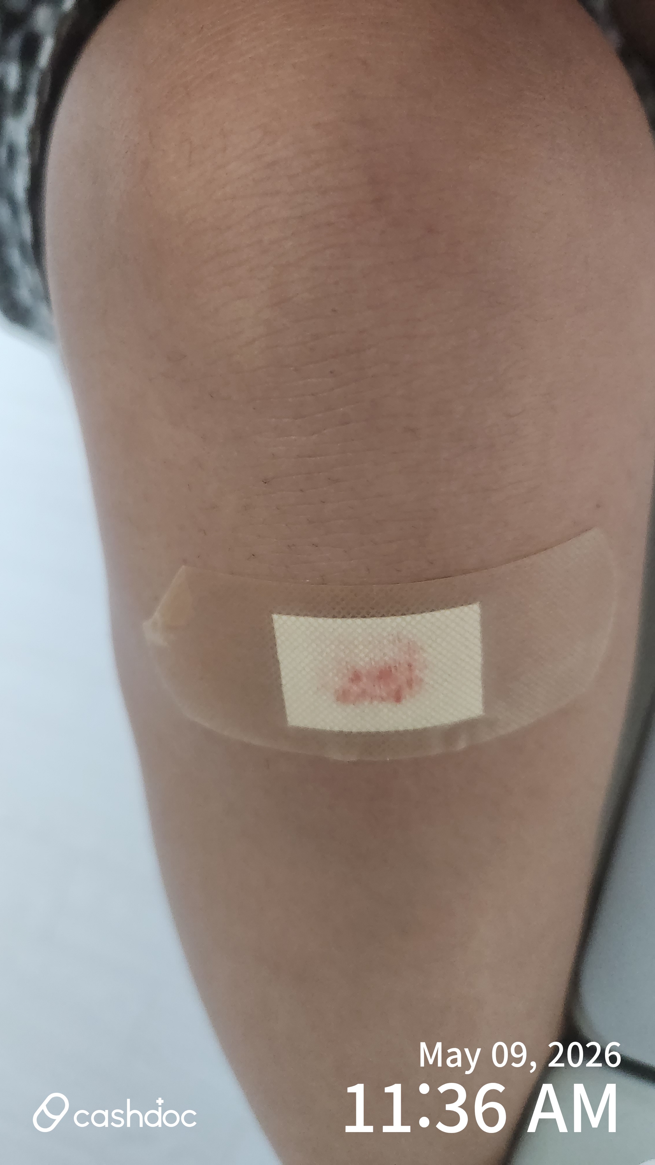 对始兴市I-End儿科诊所进行的紧急伤口消毒进行回顾