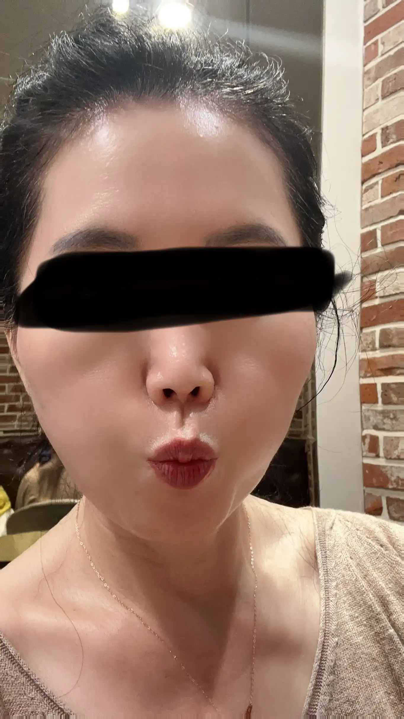 후