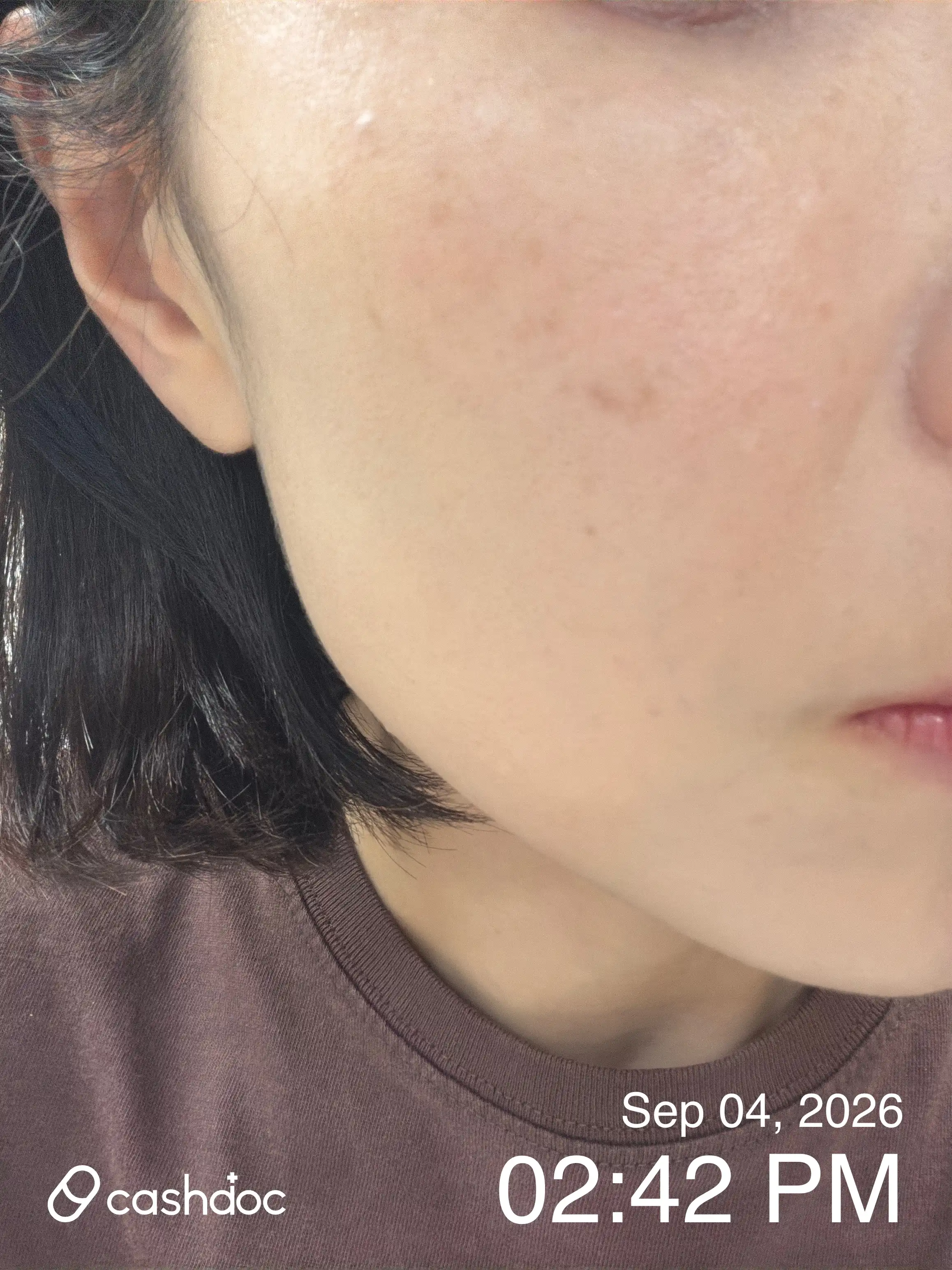 Review photo