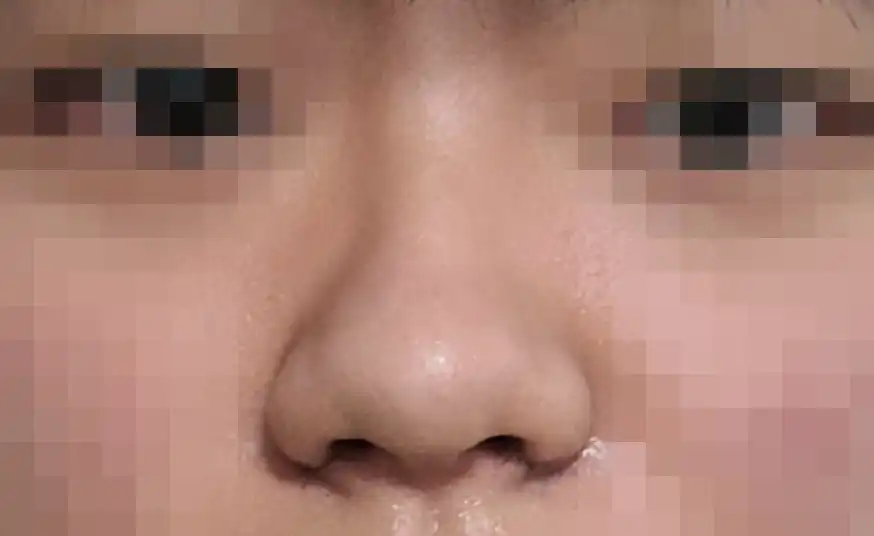 후