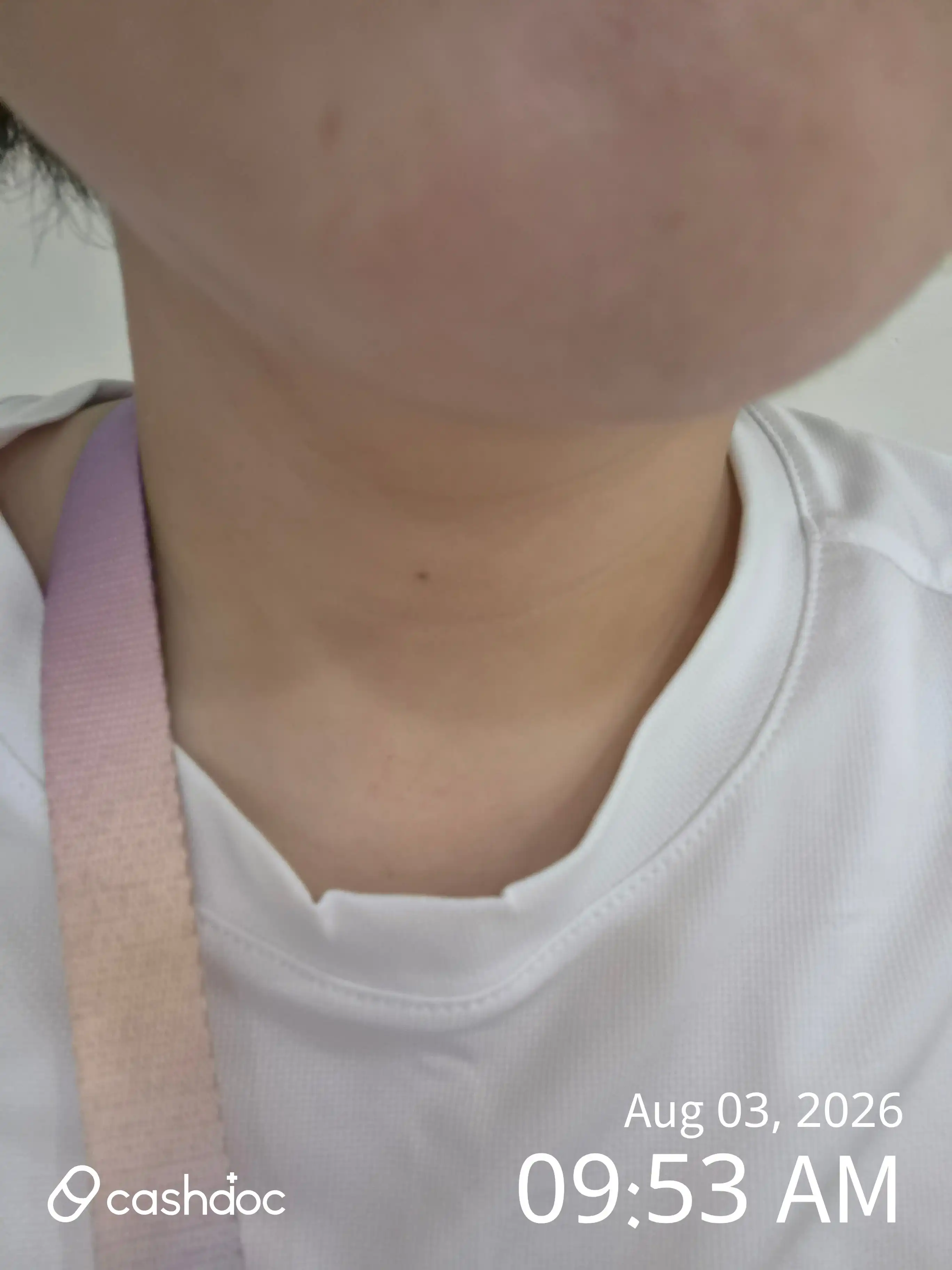 レビュー写真