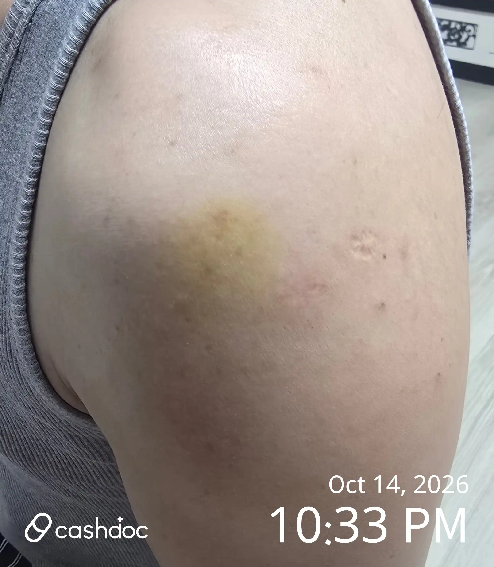 Review photo
