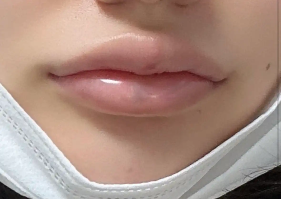 리뷰 사진 2