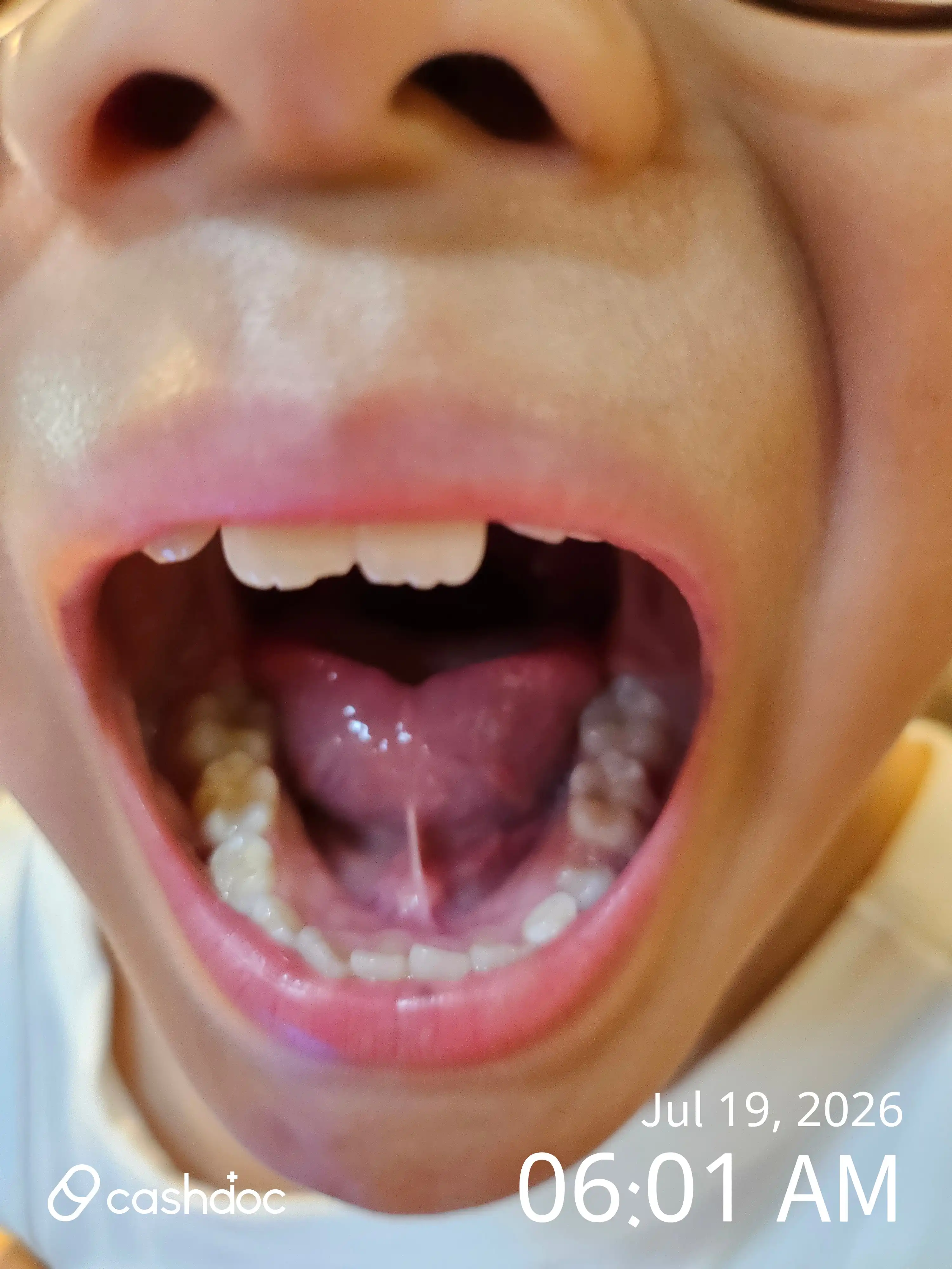 レビュー写真