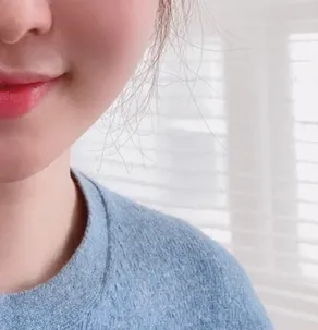 시술 전 — 인모드 리프팅