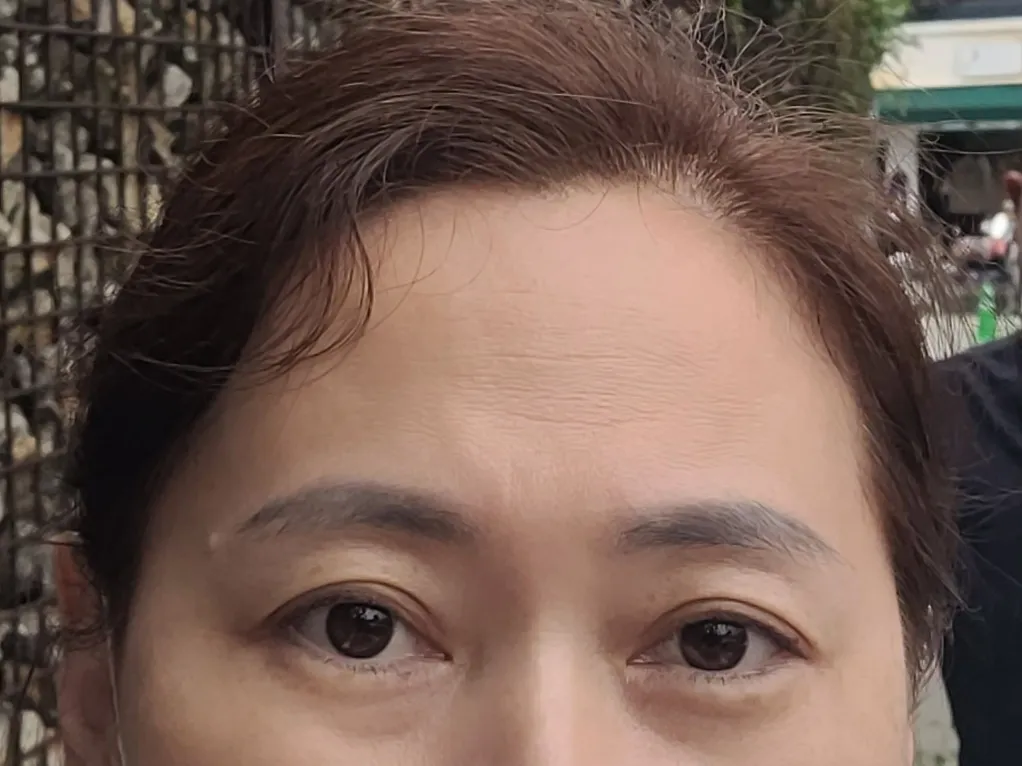 시술 전 — 연예인 눈썹반영구