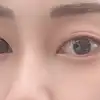前