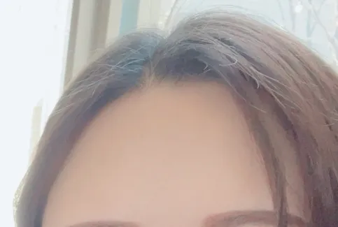 시술 전 — 핑크주사 3cc 정품개봉확인