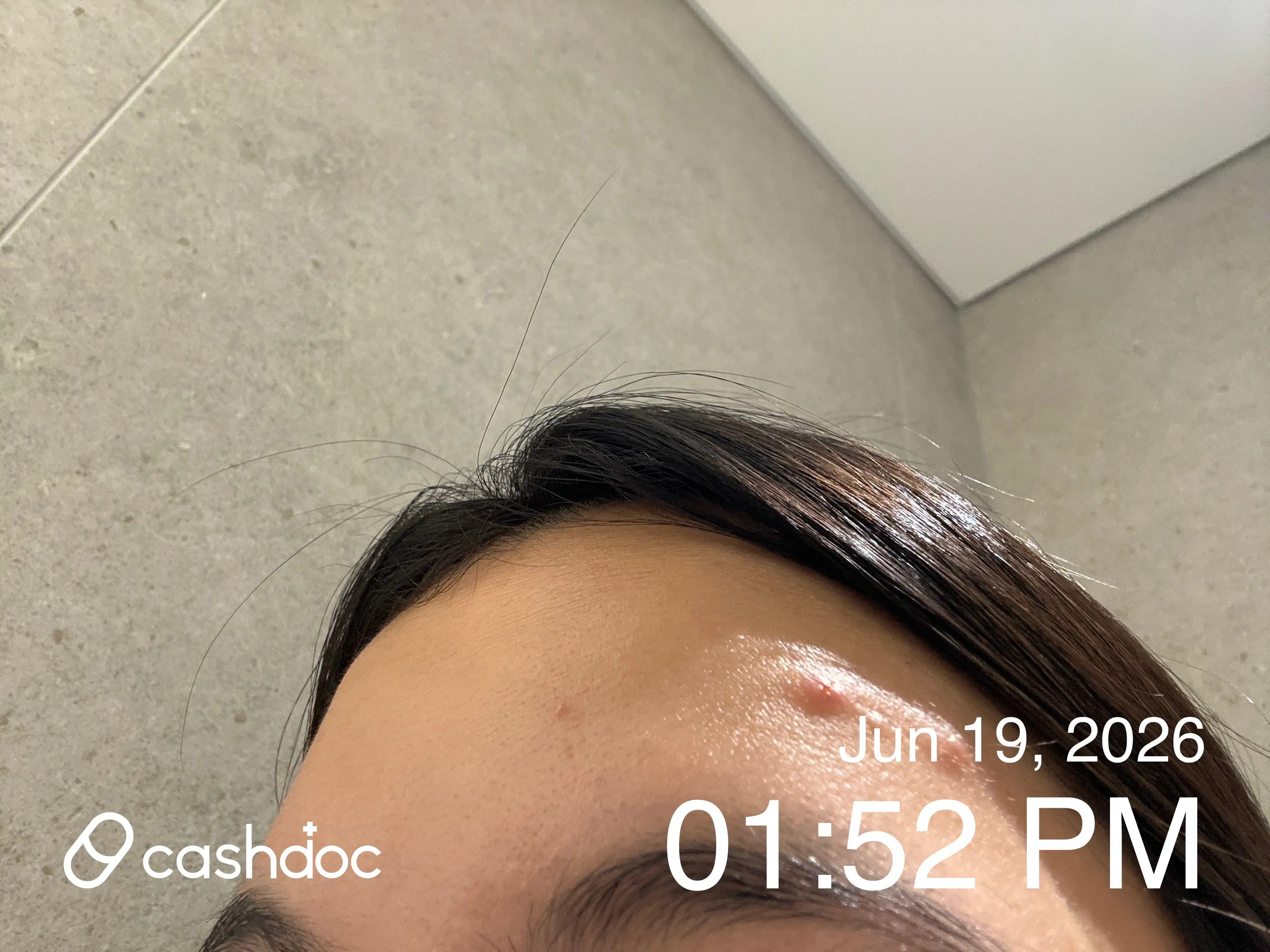 Review photo