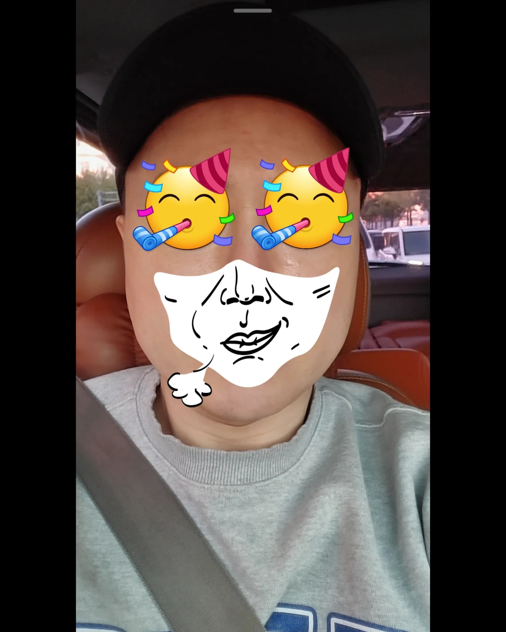 Before treatment — Suwon) Wrinkle & Jawline Botox
