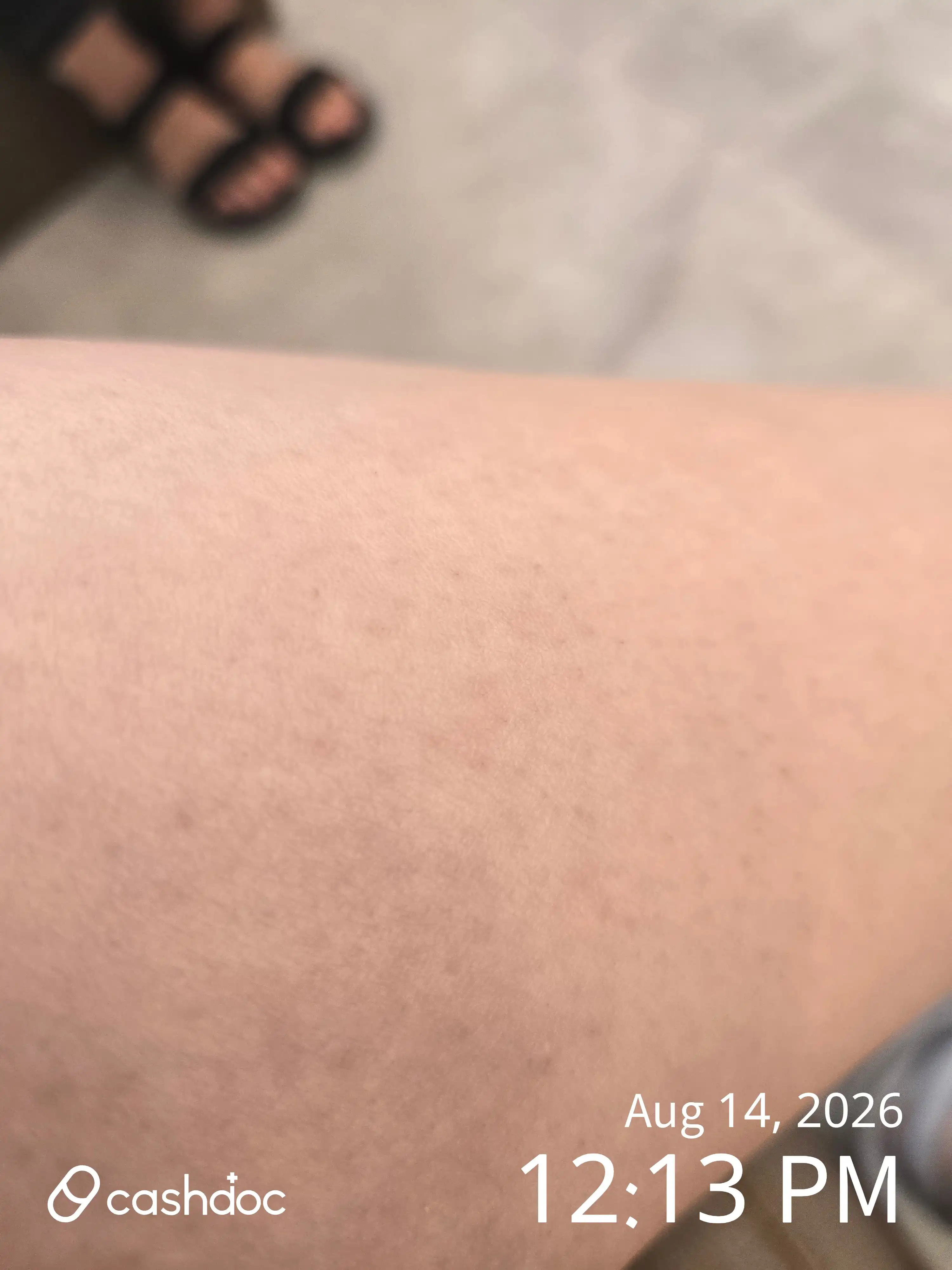 Review photo
