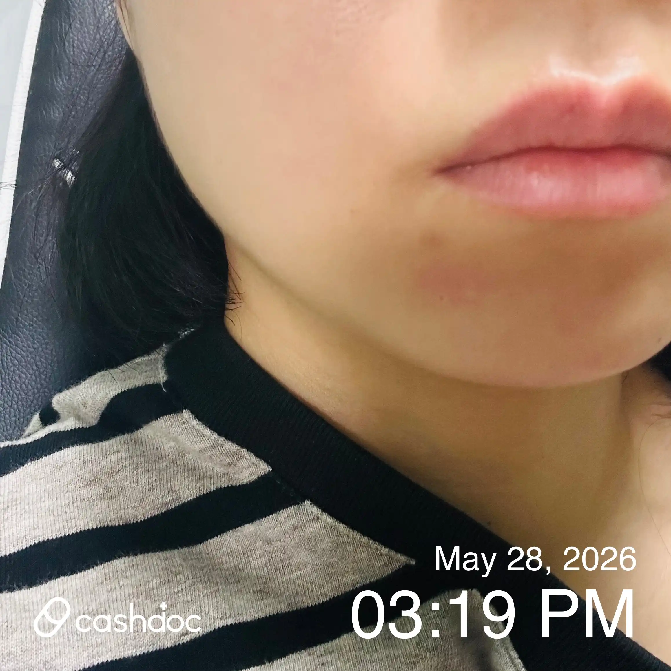 レビュー写真