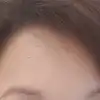 後