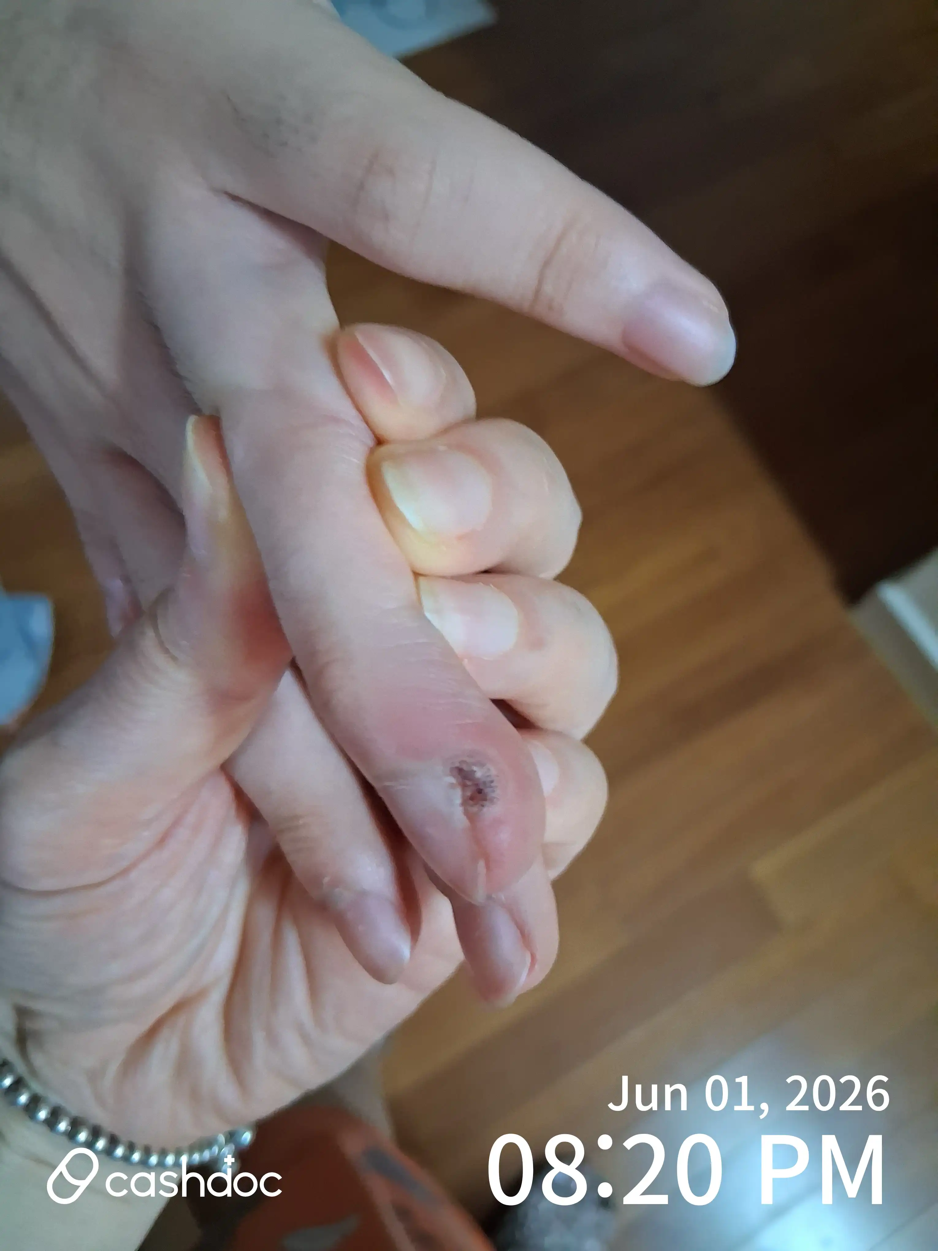 评价照片