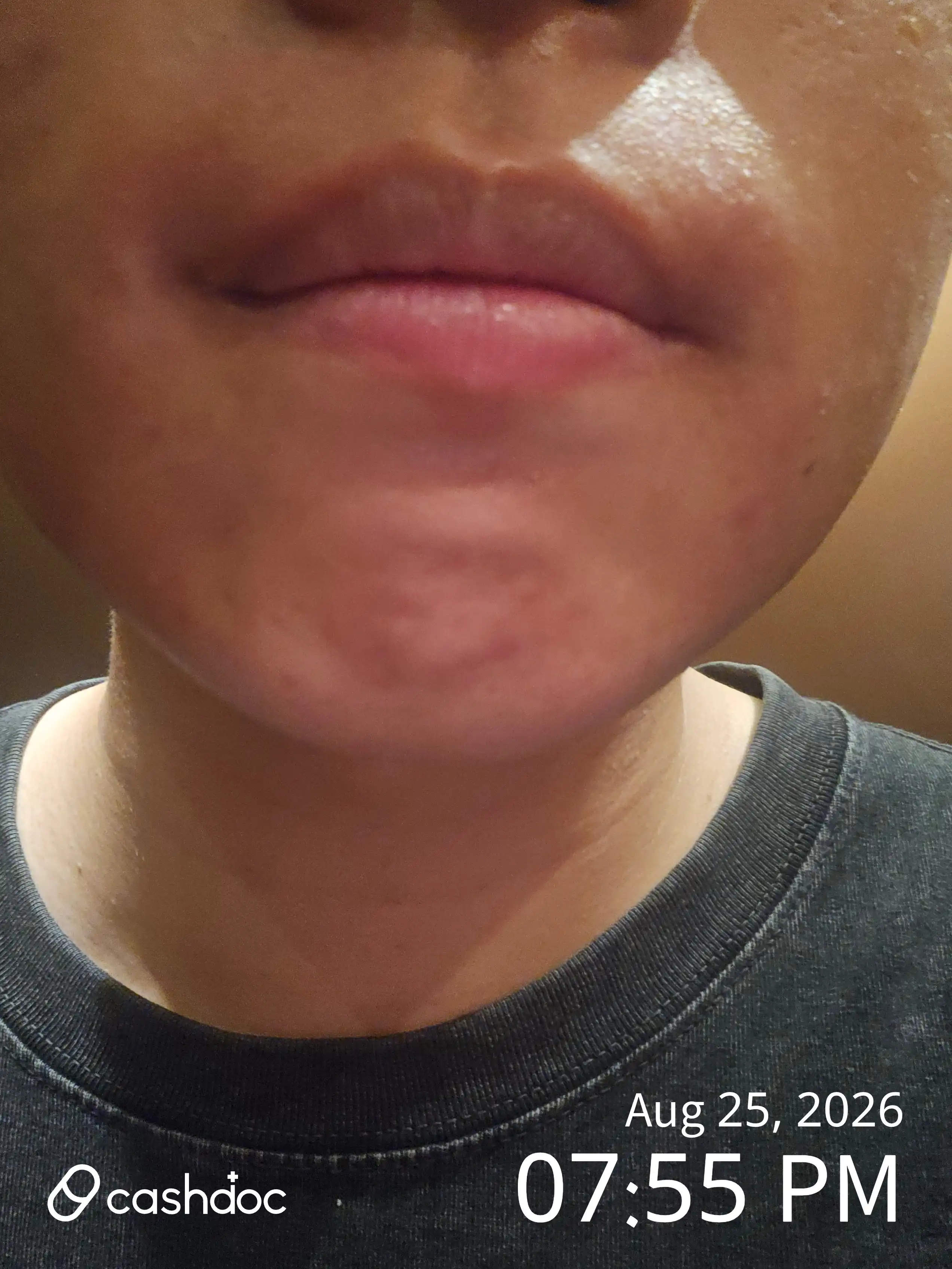 Review photo