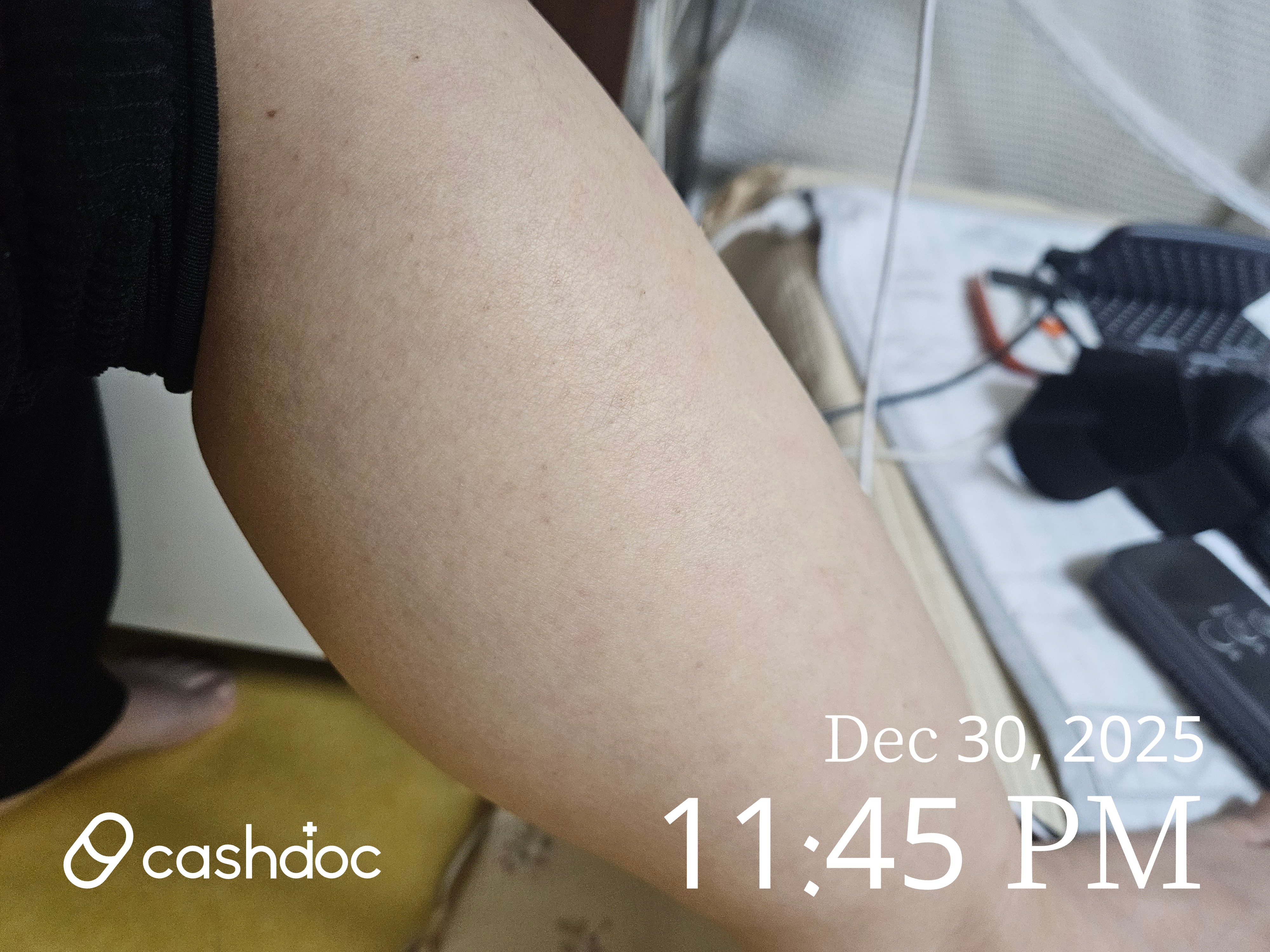 도봉구 동양당한의원에서 경추추나와 침치료 후 저림 증상 완화!