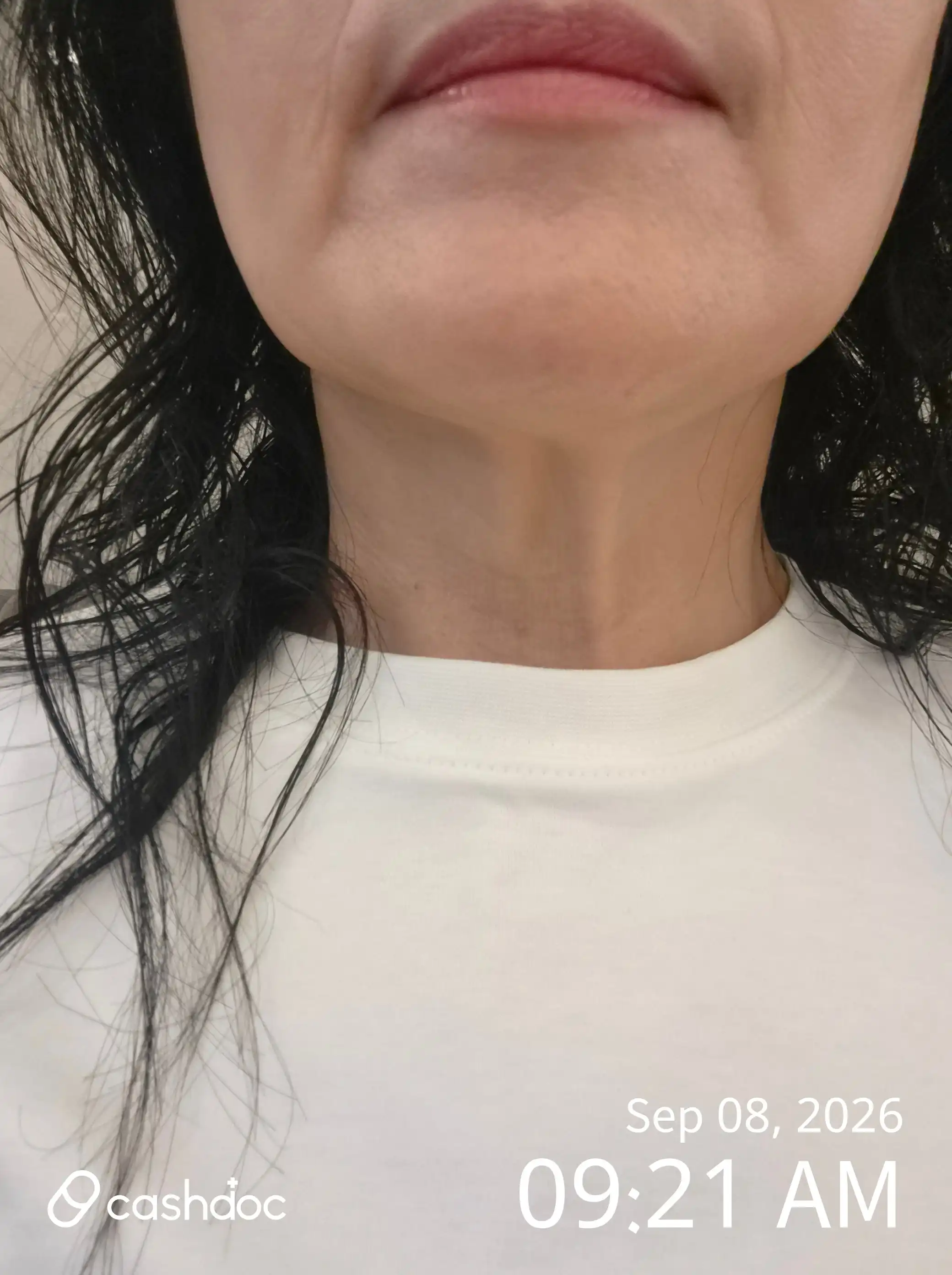Cheongju Seongmo Ear, Nose, and Throat Clinic review photo