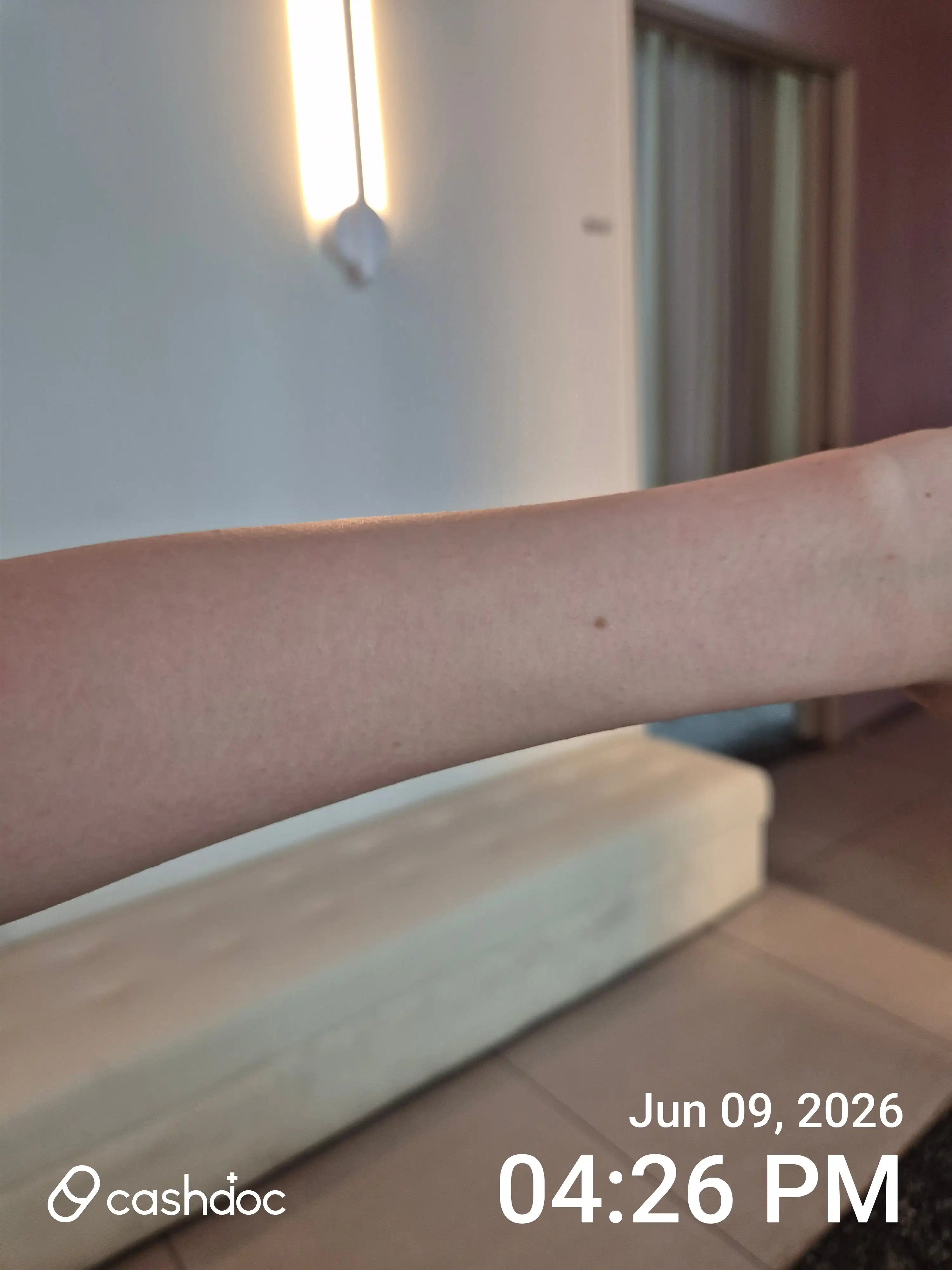 Review photo