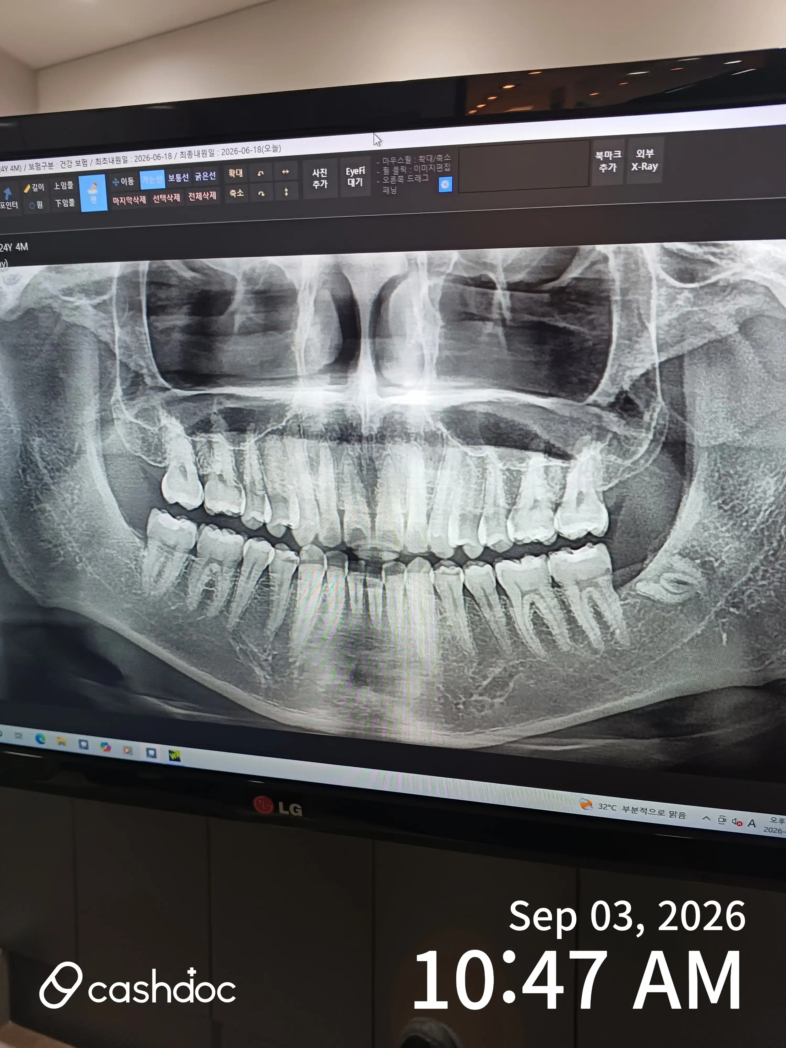 Review photo