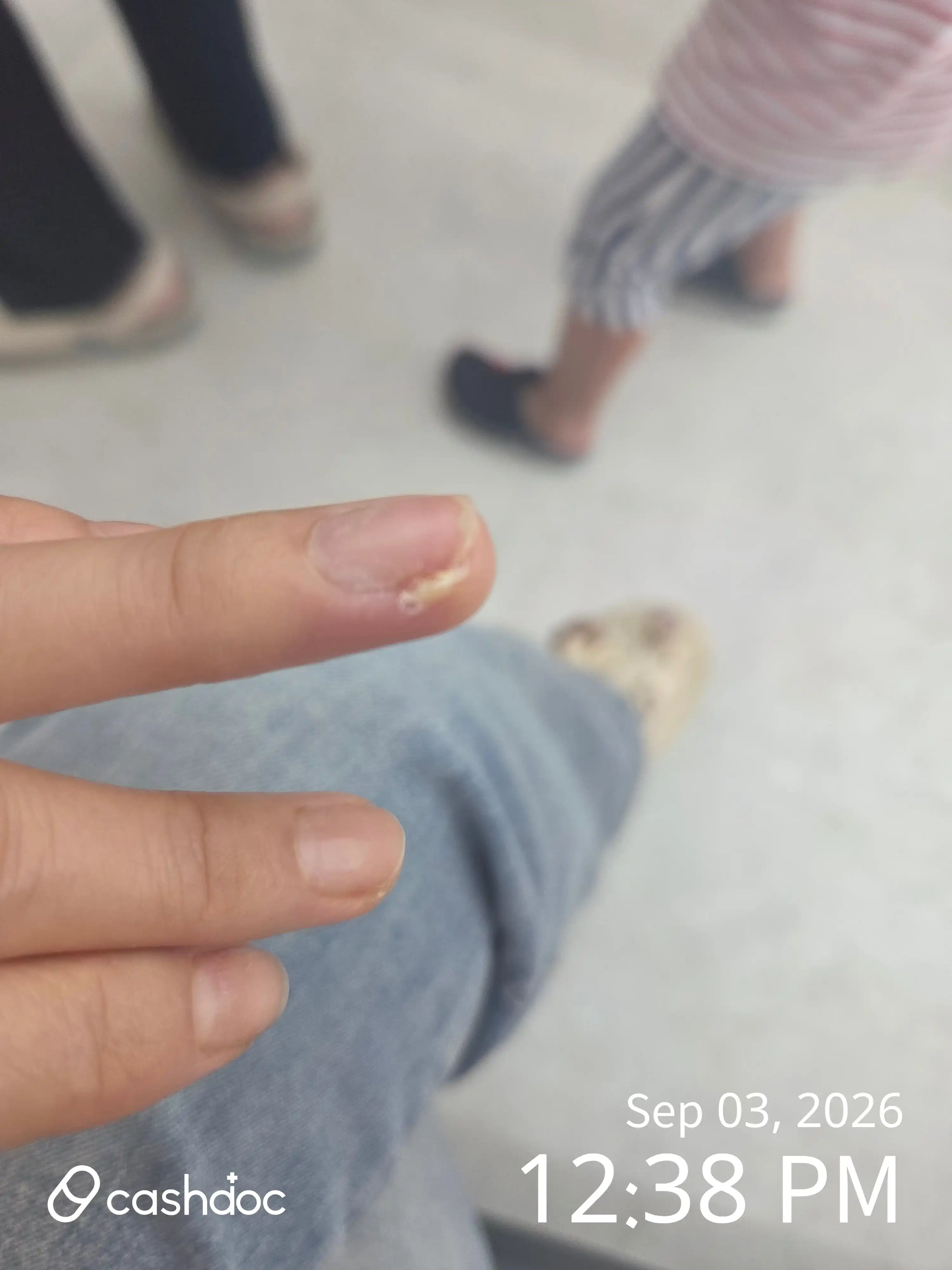 Review photo