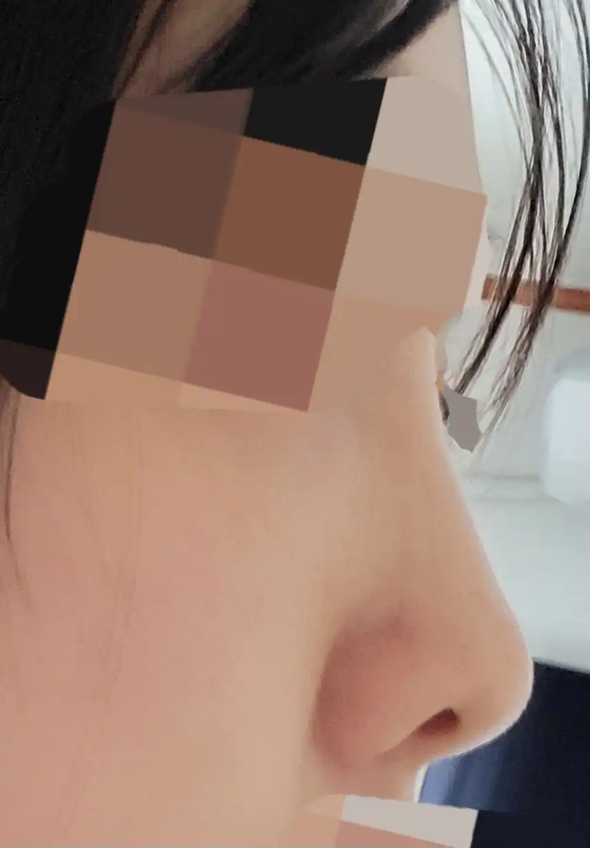 전