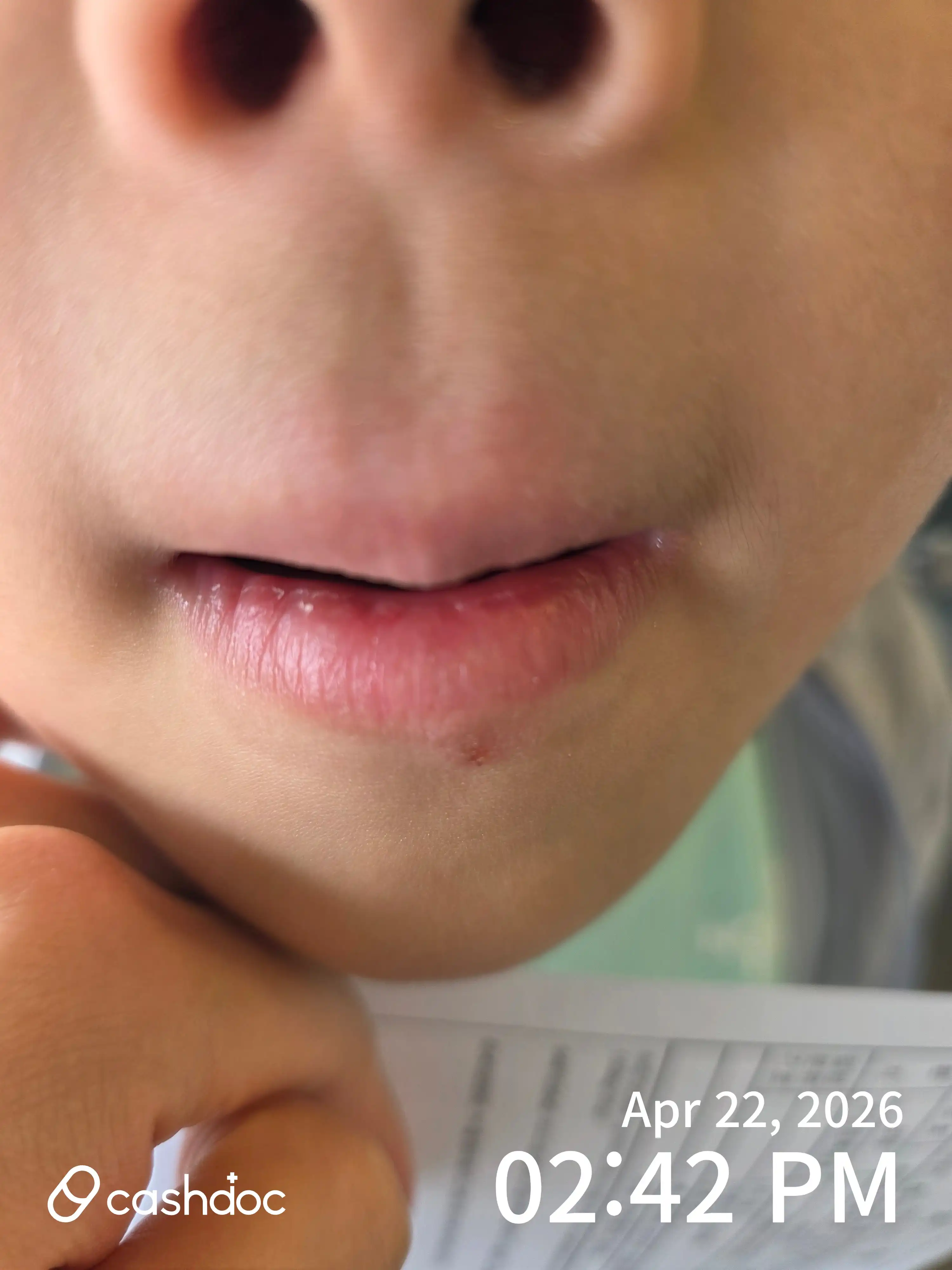 Review photo