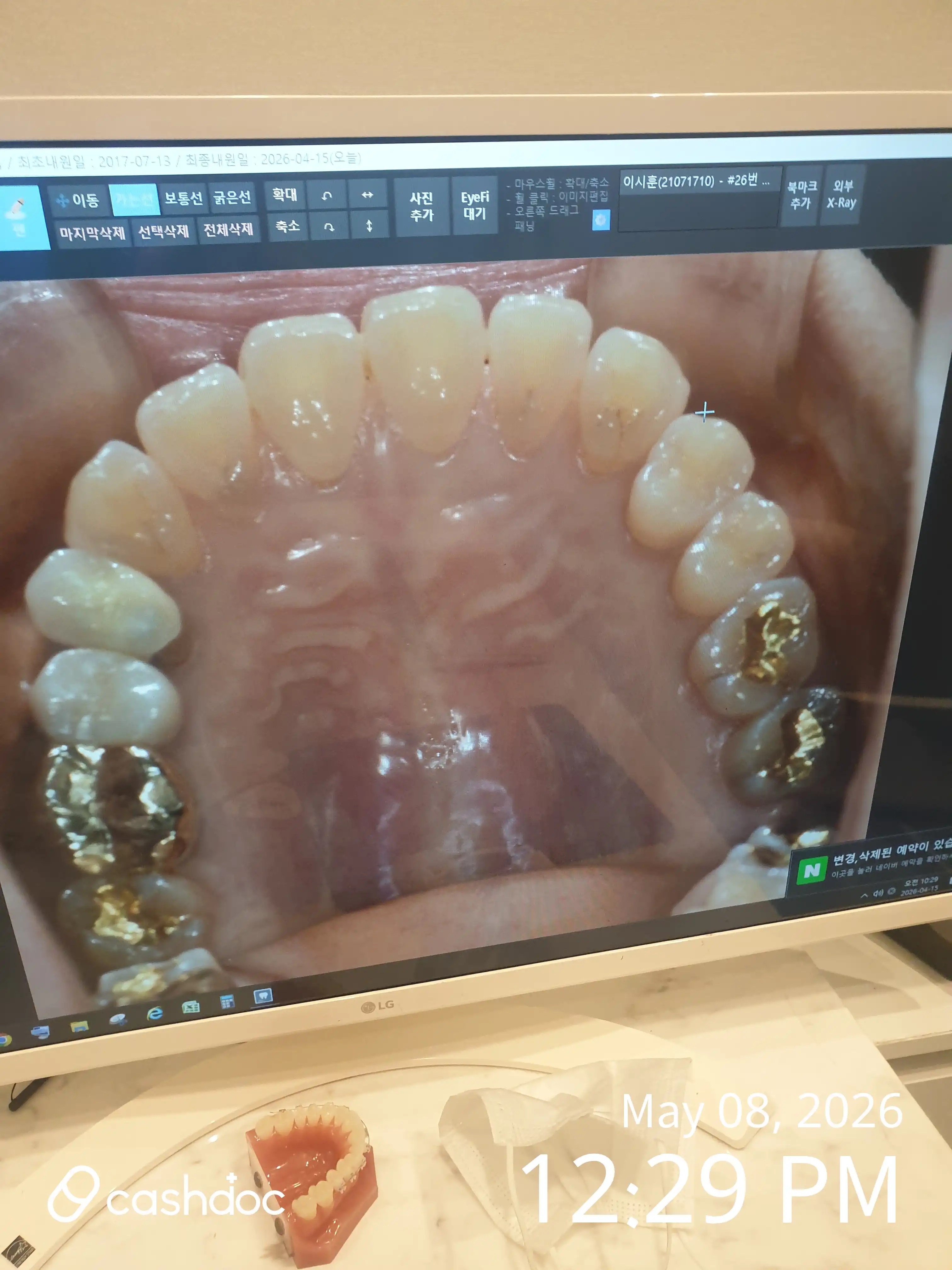 Review photo