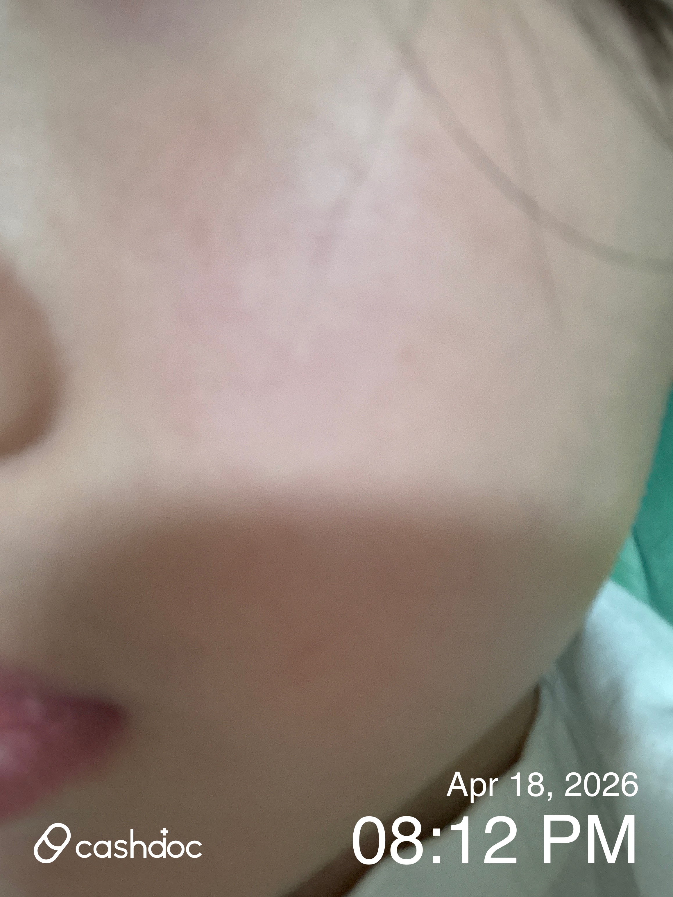 수원시 유앤미피부과, 피부 트러블 상담부터 진료까지 만족!