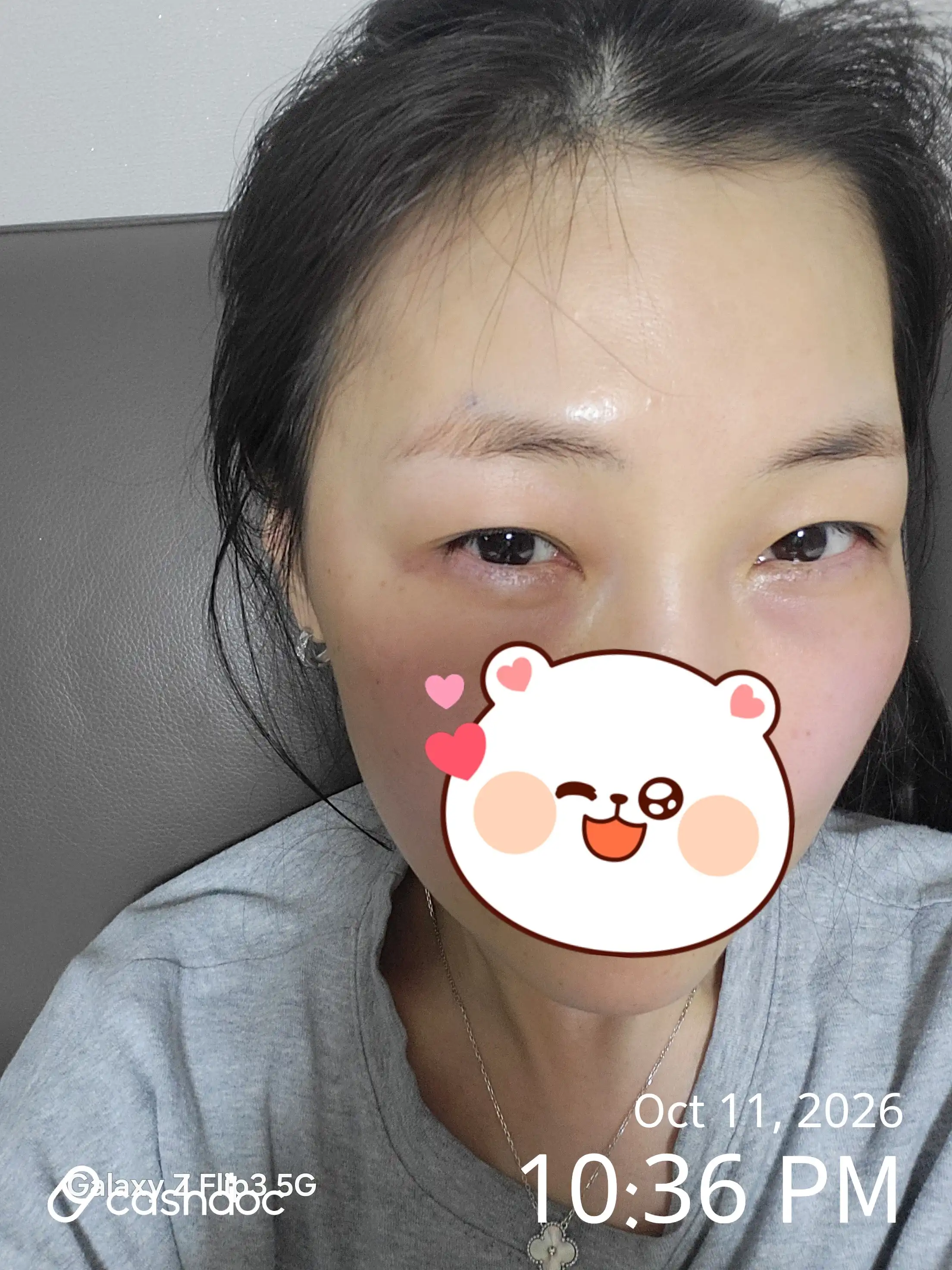 美璞诊所 东柏分院 评价照片