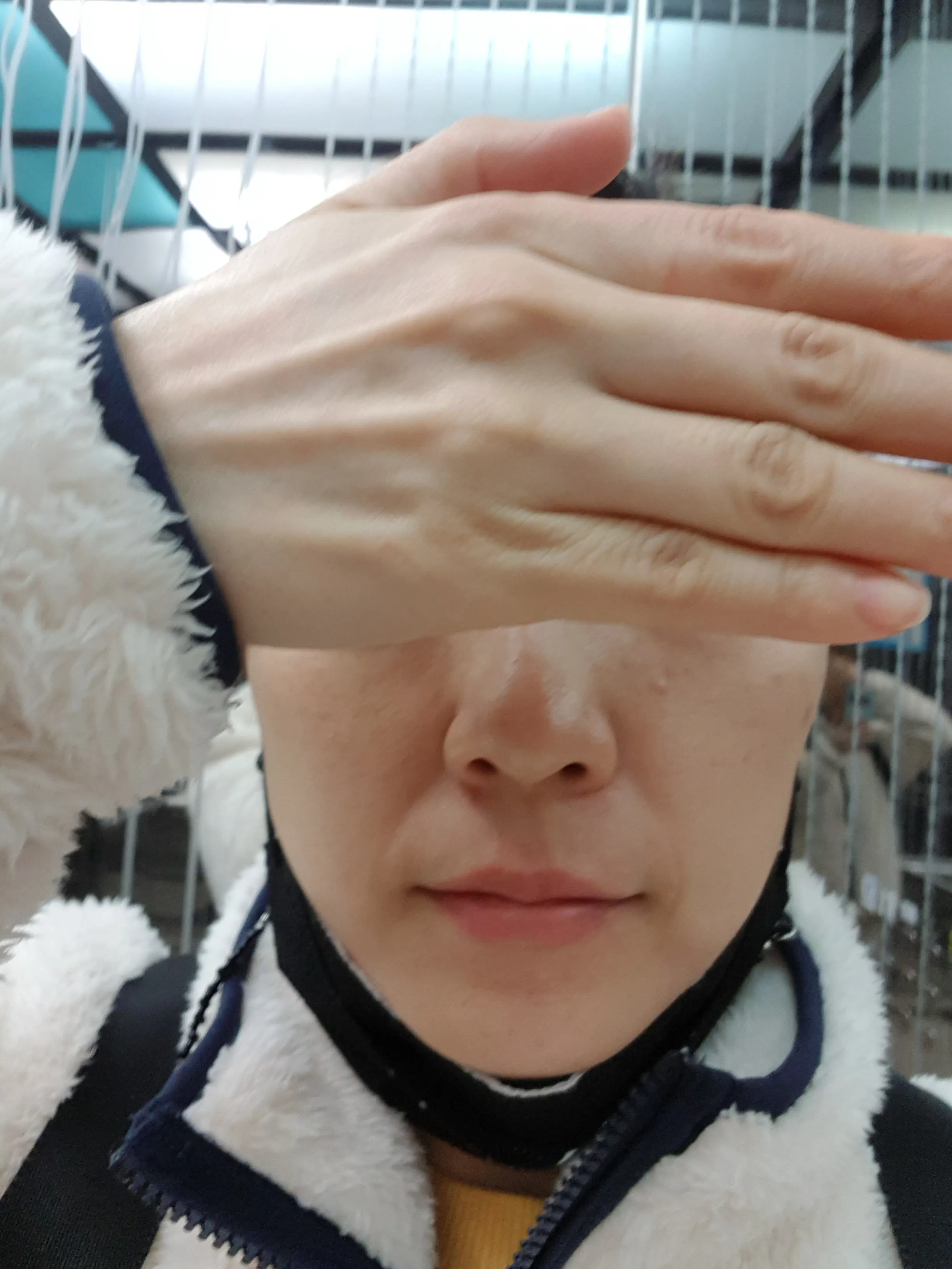 시술 전 — 생기있는 톤업 입술반영구