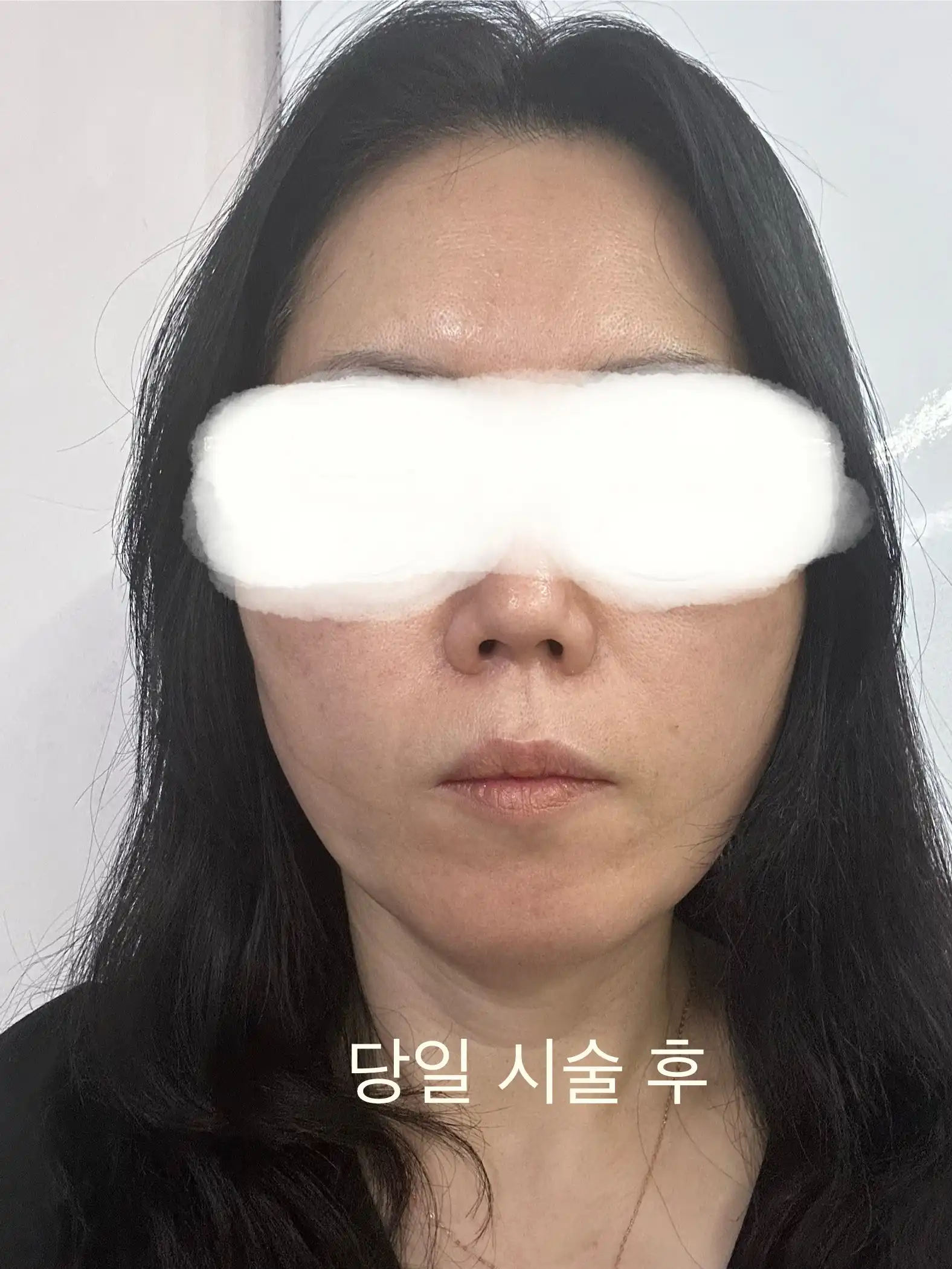 후