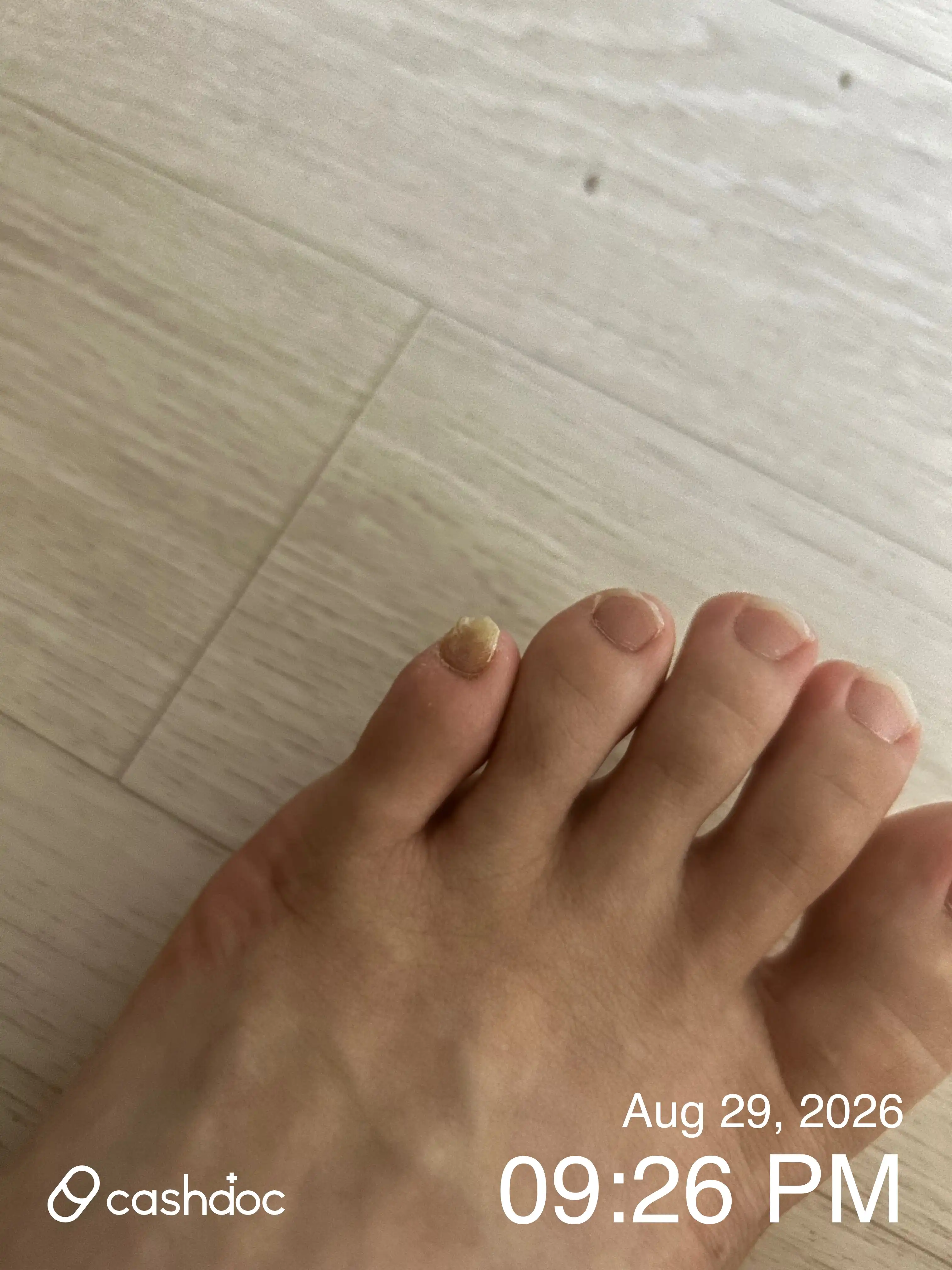 Review photo