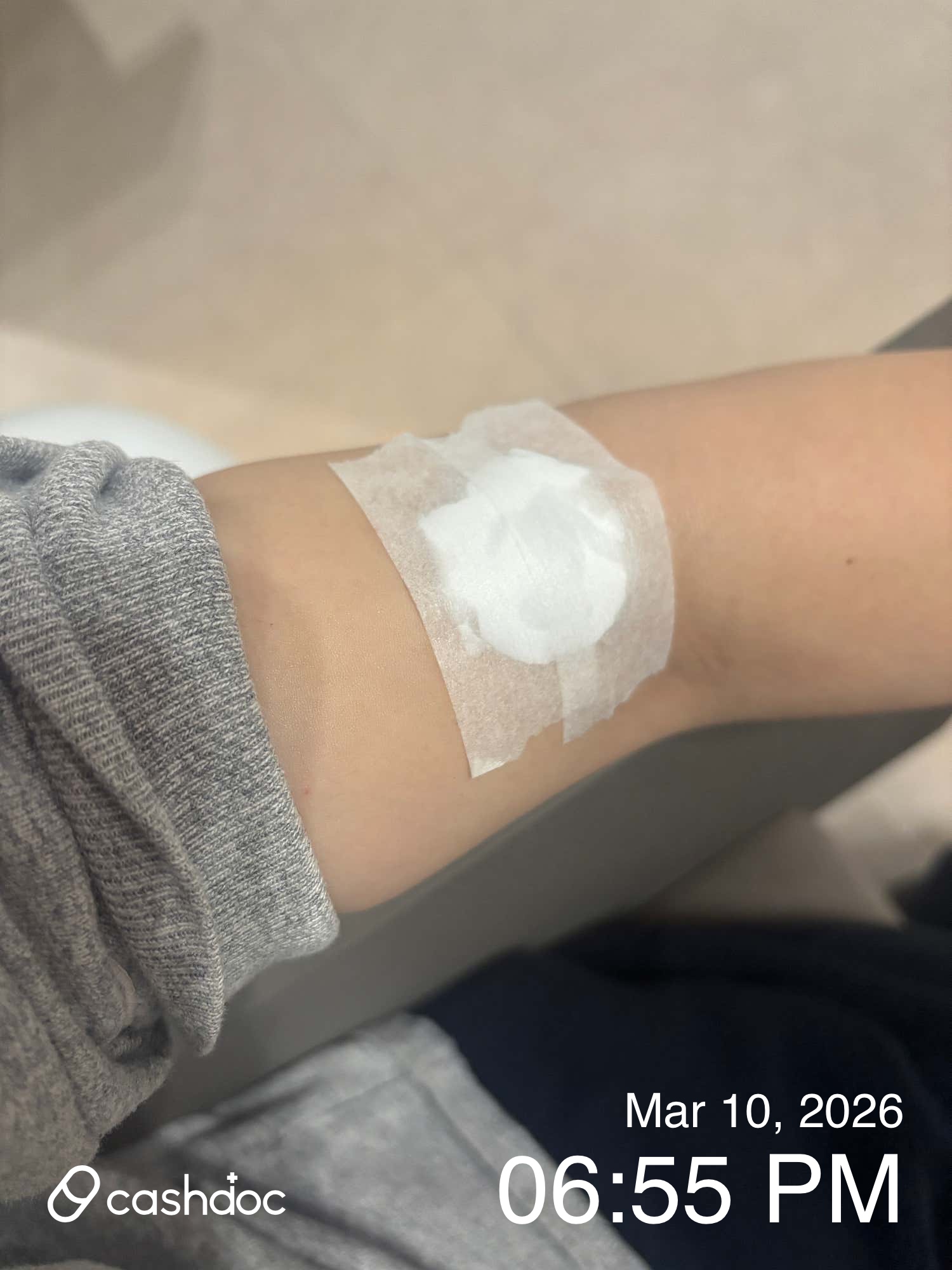 남동구 지오피부과의원 문신 제거 후기: 회차별로 변화가 눈에 띄어요!