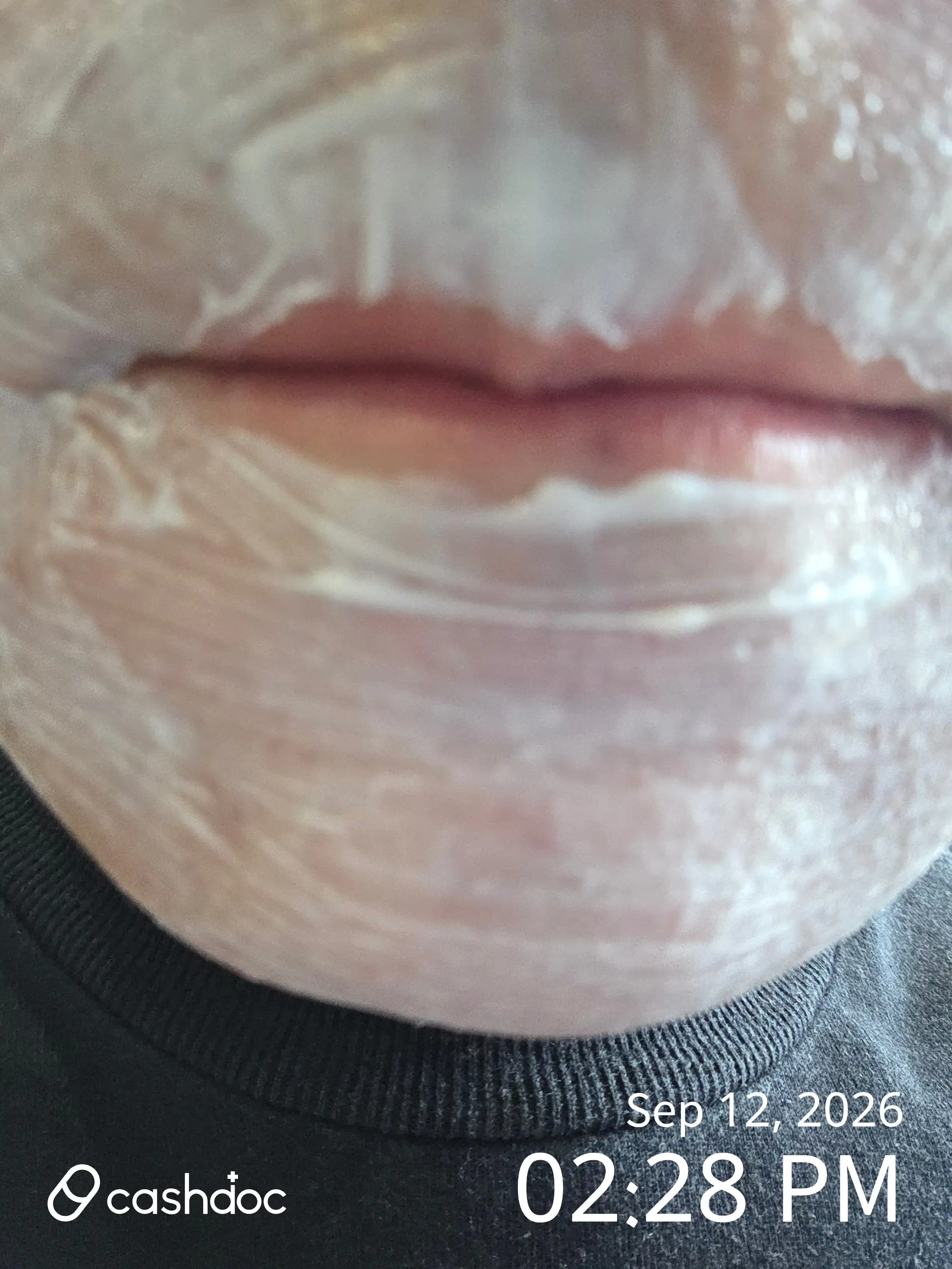 评价照片