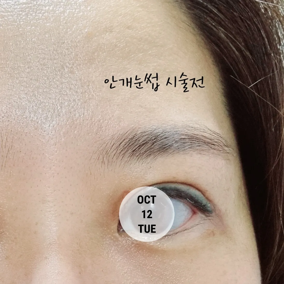 시술 전 — 미케이 반영구_눈썹, 입술, 아이라인