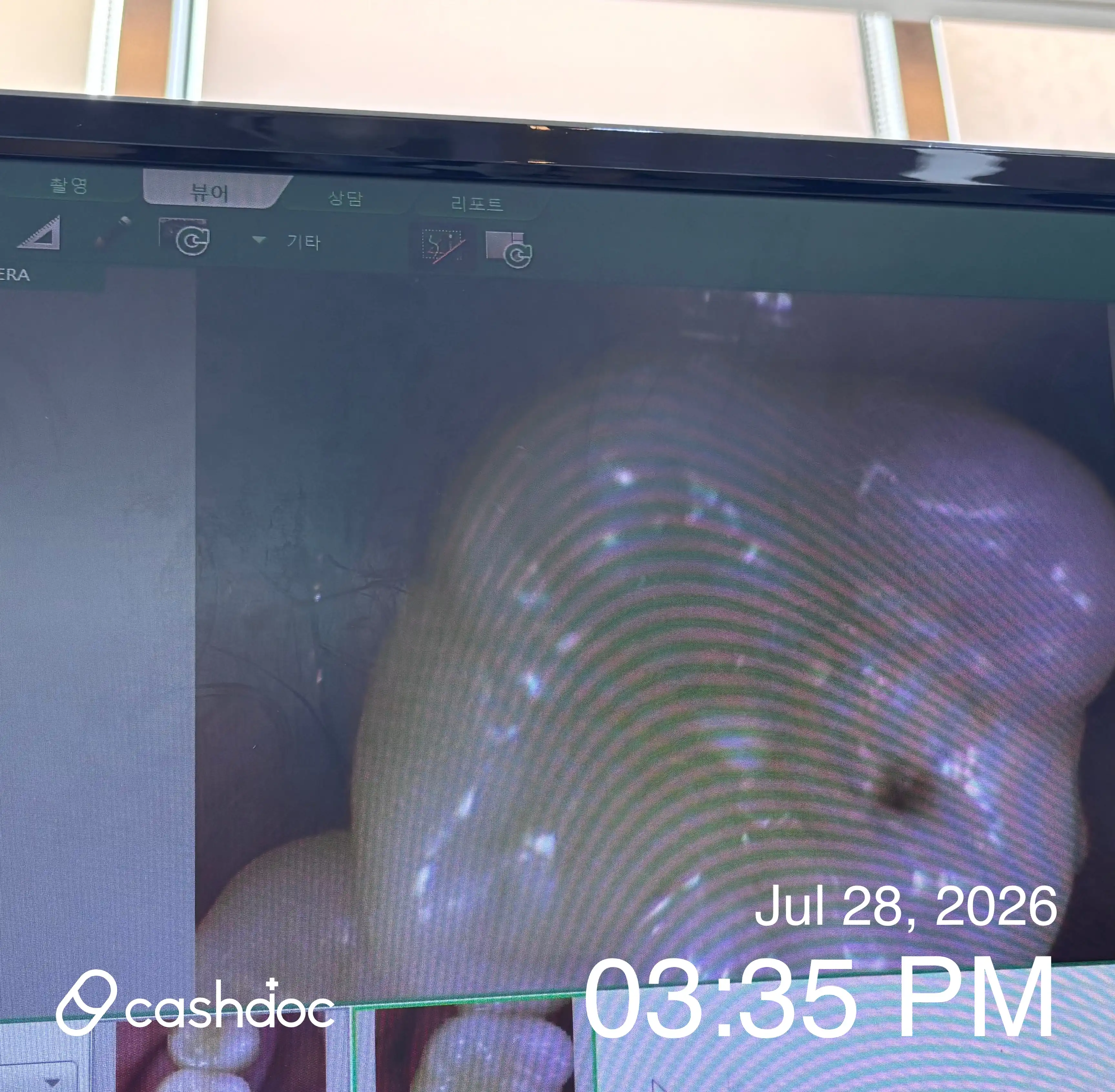 Review photo