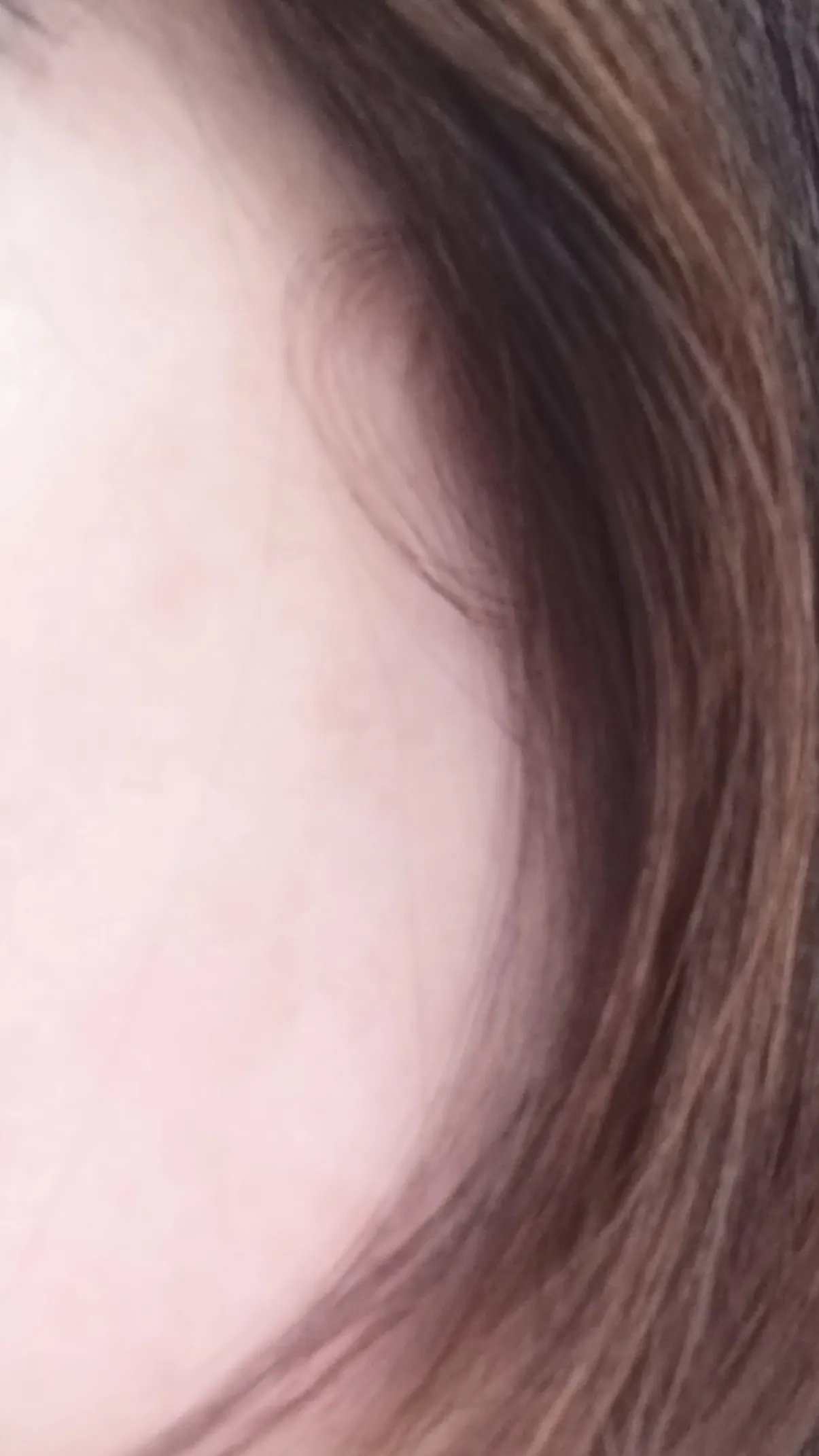 After treatment — Skin Regeneration #Skin Elasticity #For Fine Lines: Rejuran Healer