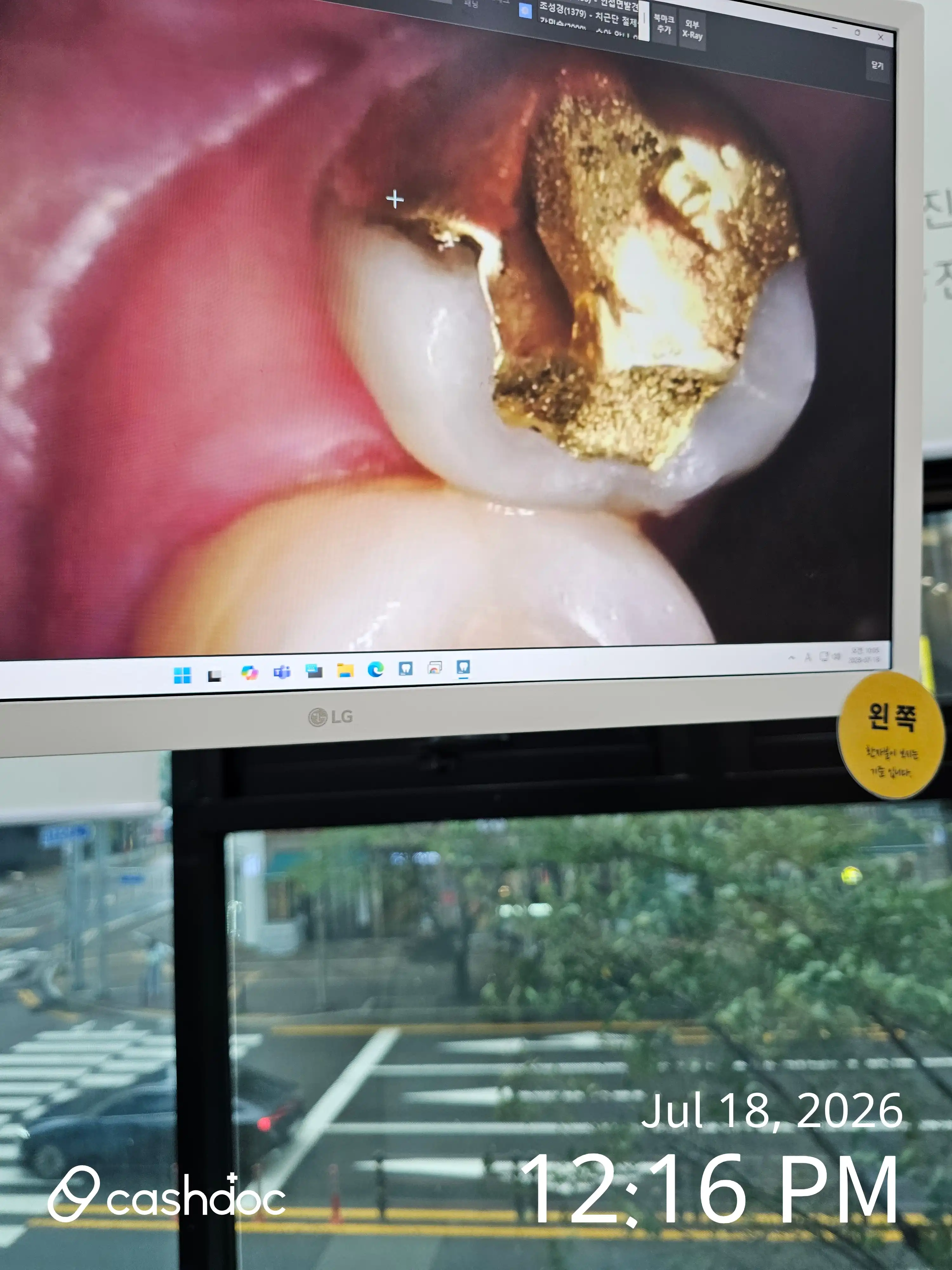 レビュー写真