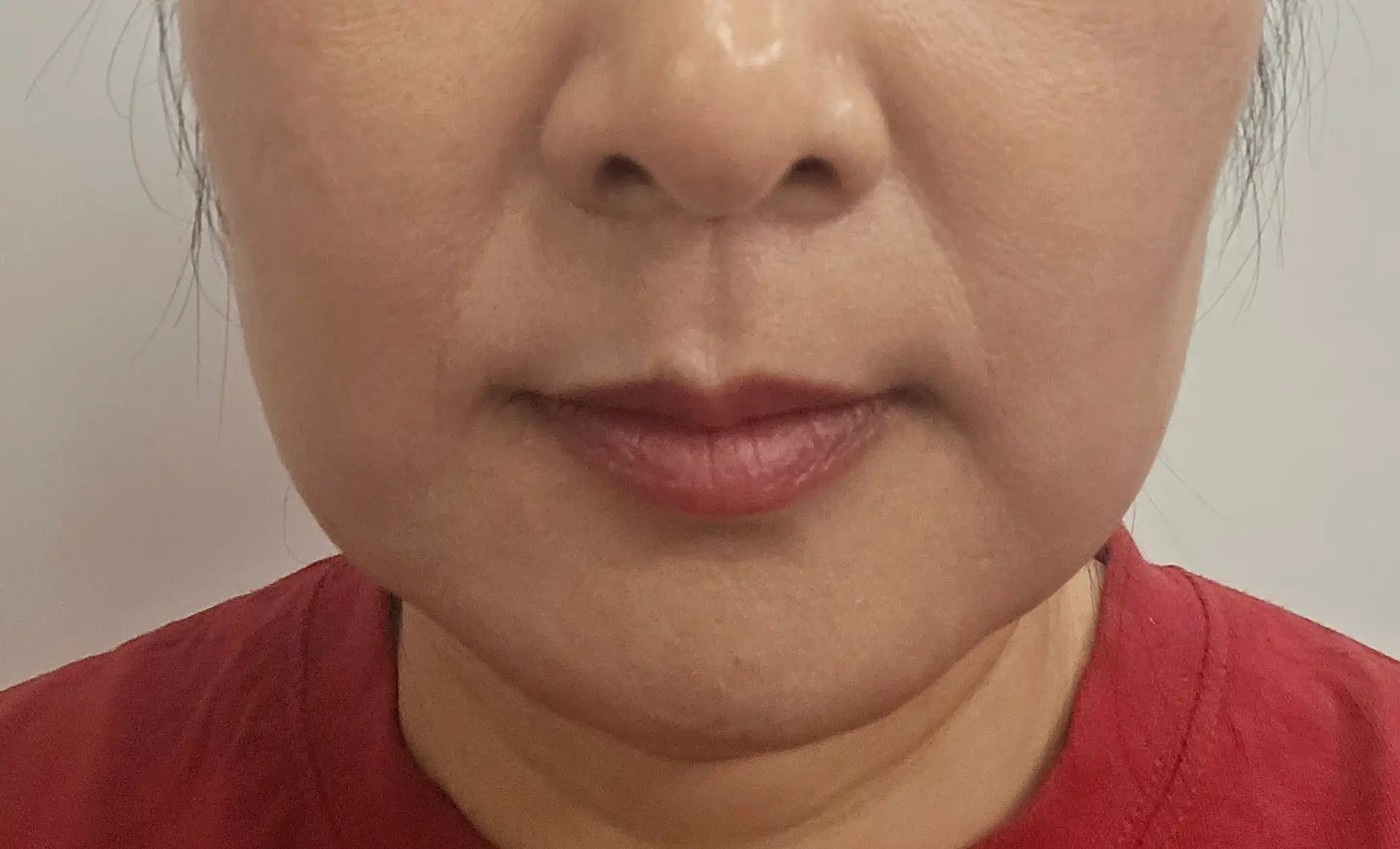 후