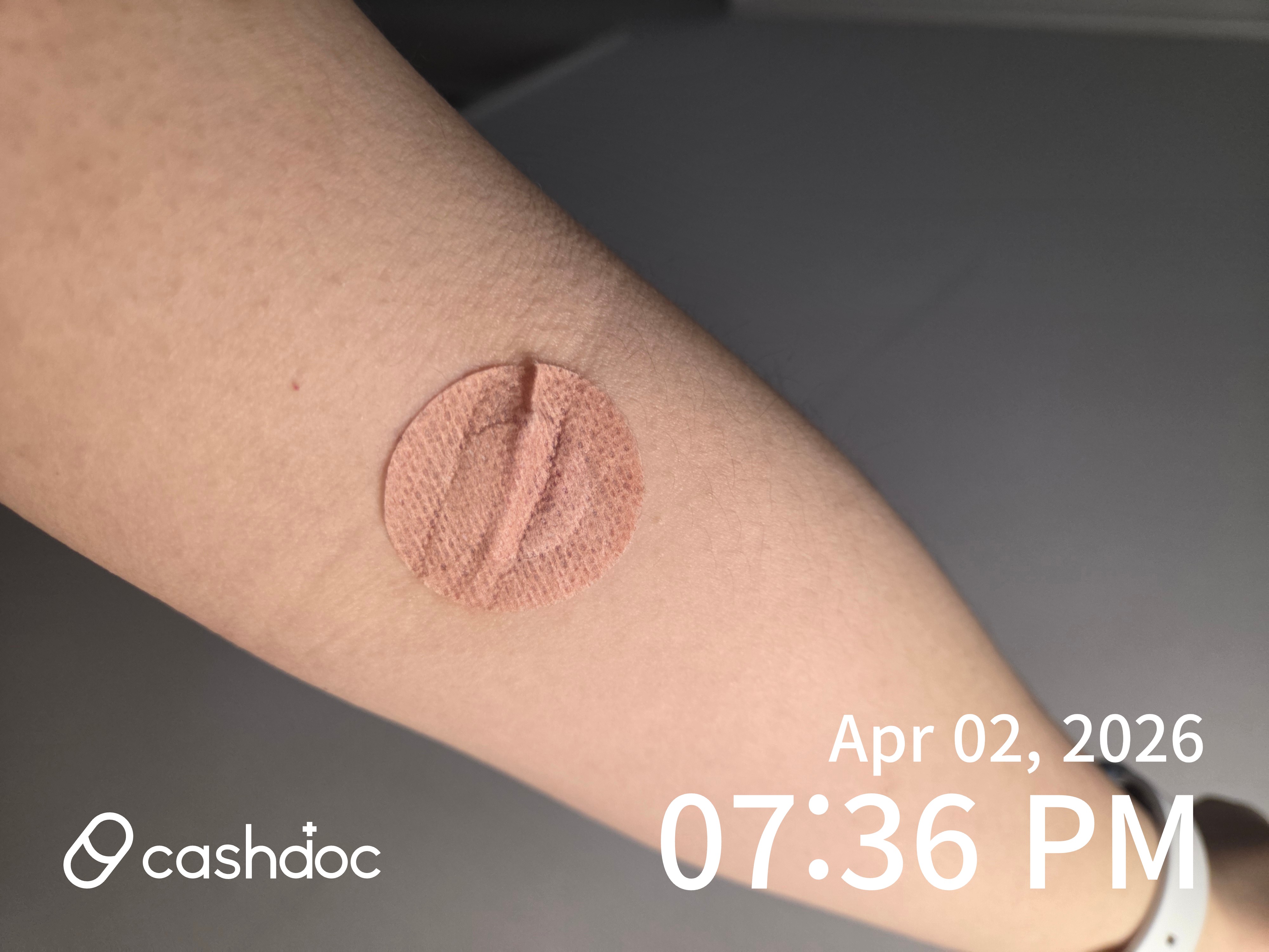 영등포 애플산부인과의원에서 비타민D 부족 발견 후 처방받아요