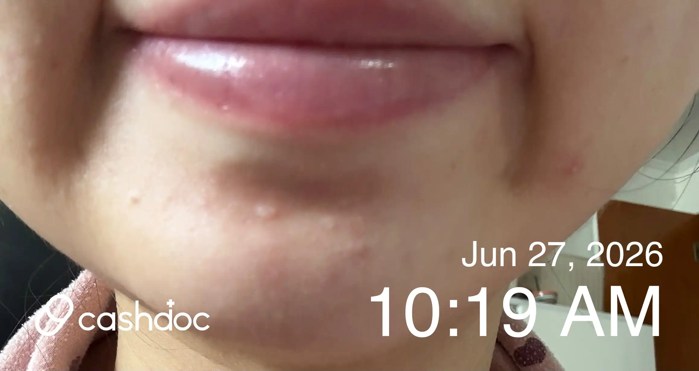 Review photo